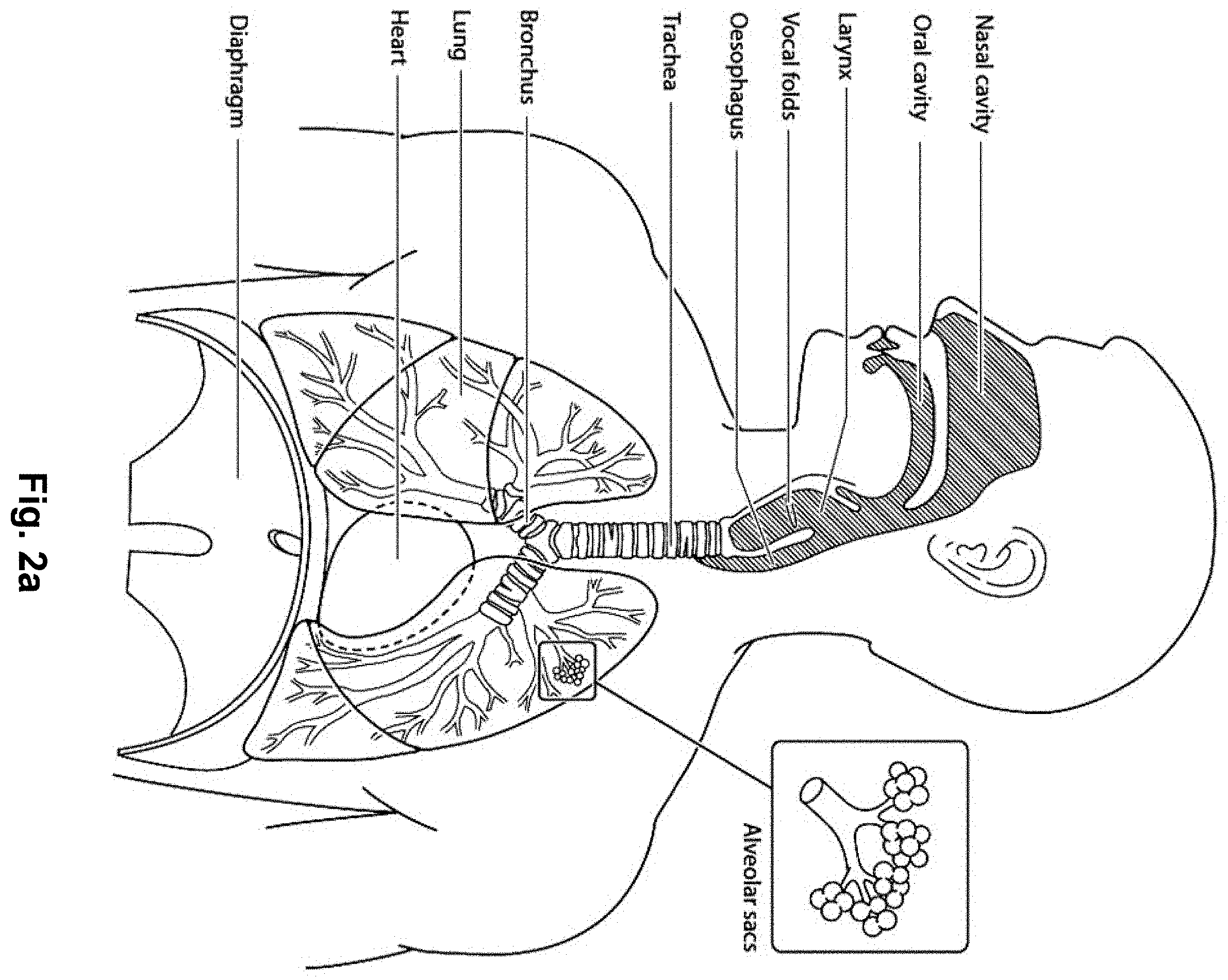 Patent US11793969 Figure 4 – Vent arrangement for a respiratory device