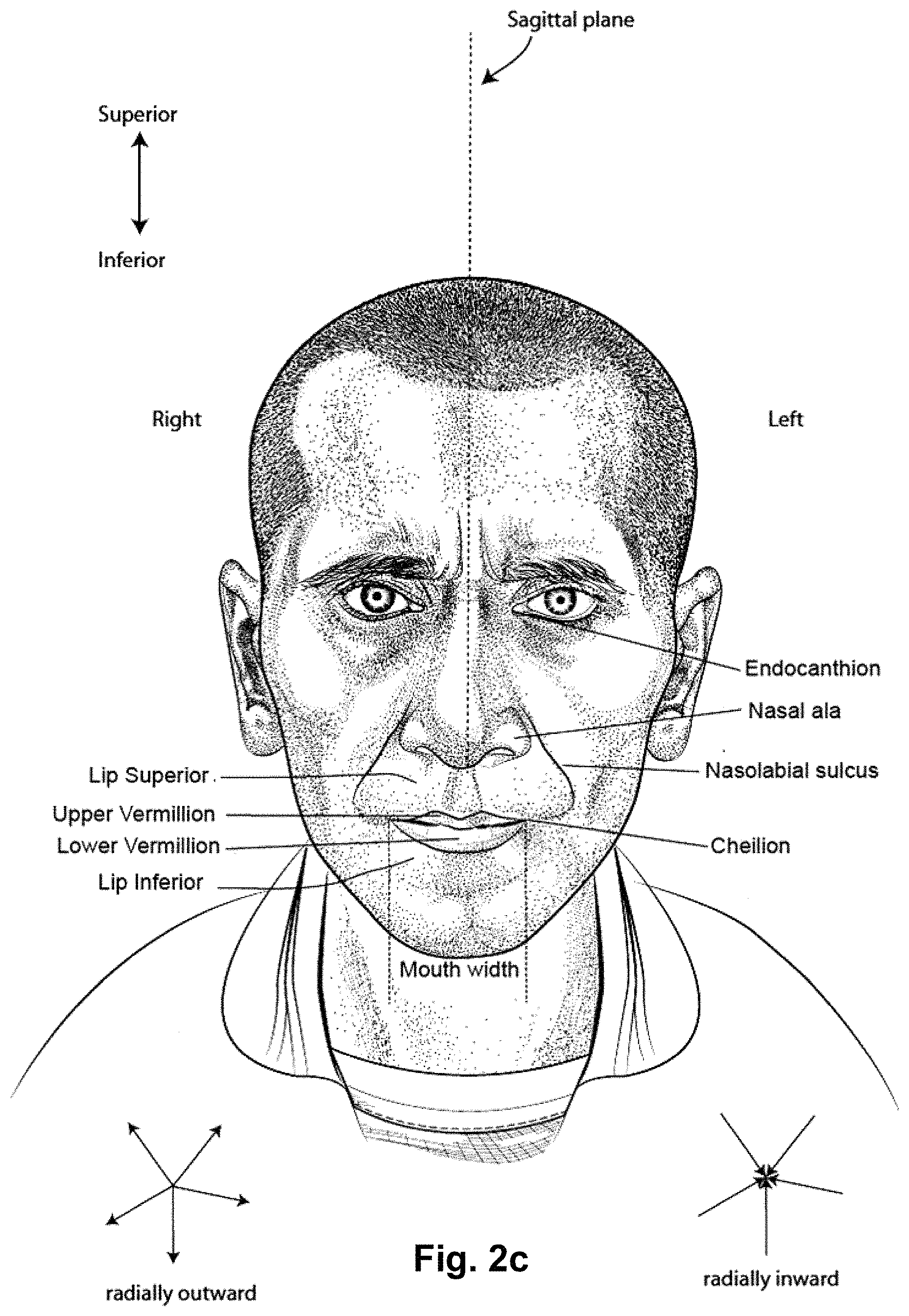 Patent US11793969 Figure 6 – Vent arrangement for a respiratory device