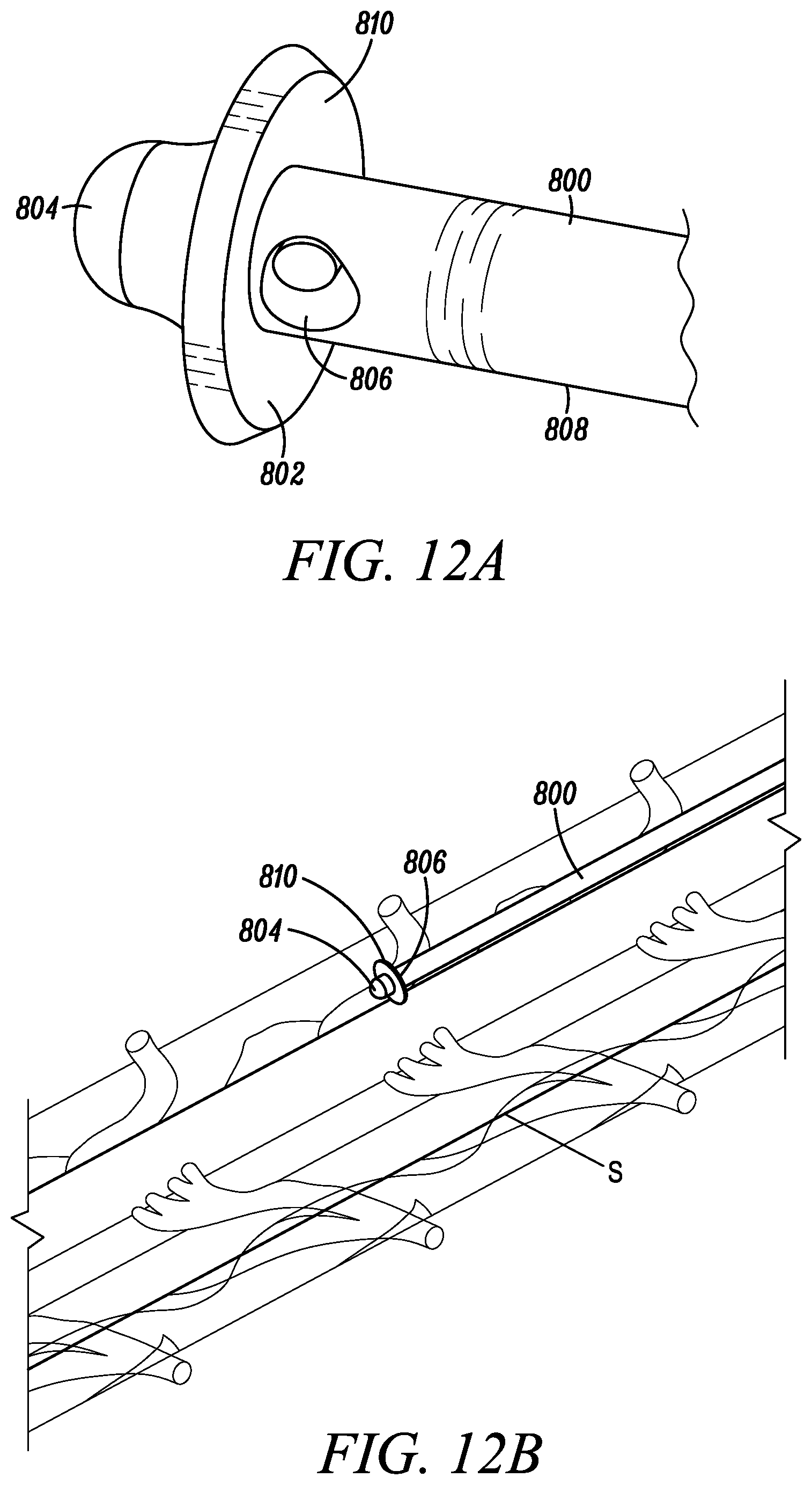 Patent US11793971 Figure 9 – Curved catheter for increased intrathecal drug dispersion