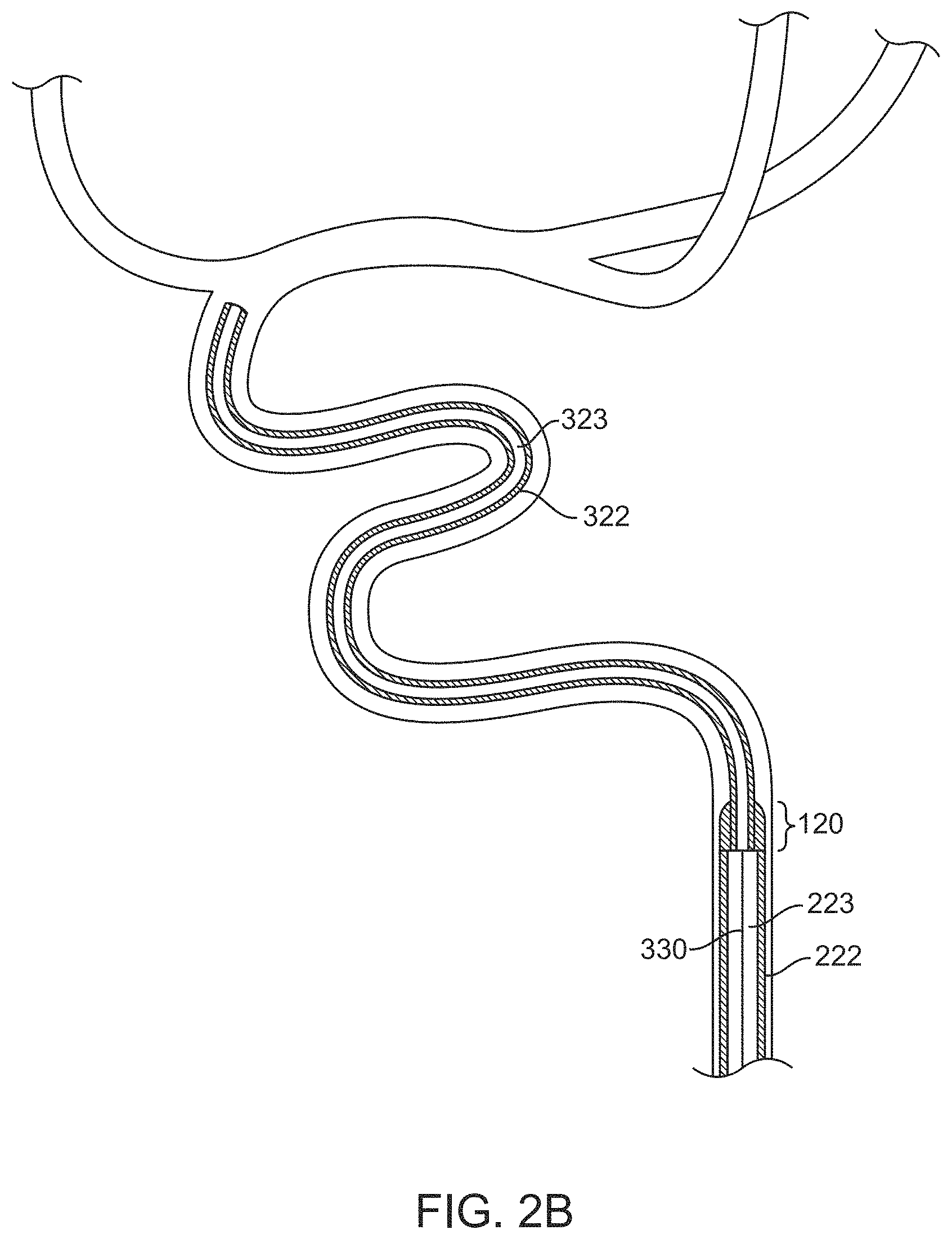 Patent US11793972 Figure 3 – Rapid aspiration thrombectomy system and method
