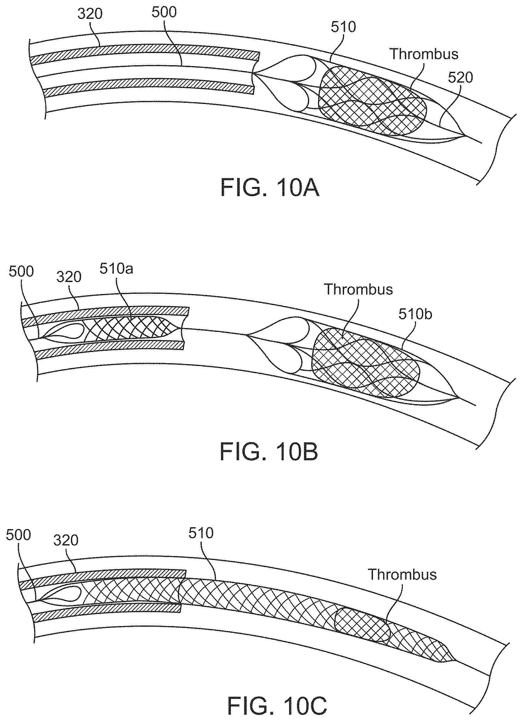 Patent US11793972 Figure 11 – Rapid aspiration thrombectomy system and method