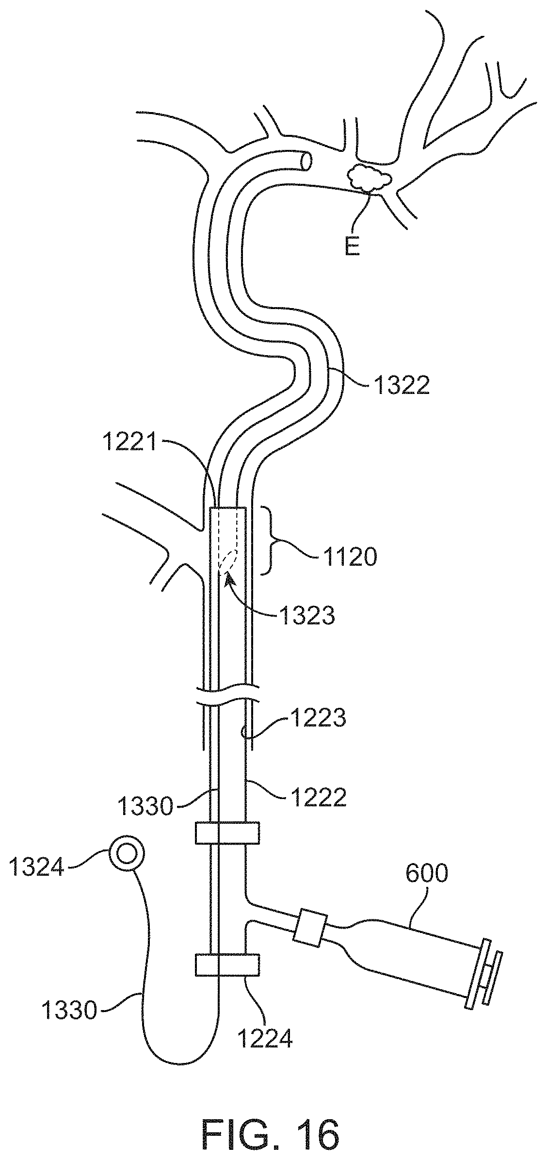 Patent US11793972 Figure 19 – Rapid aspiration thrombectomy system and method