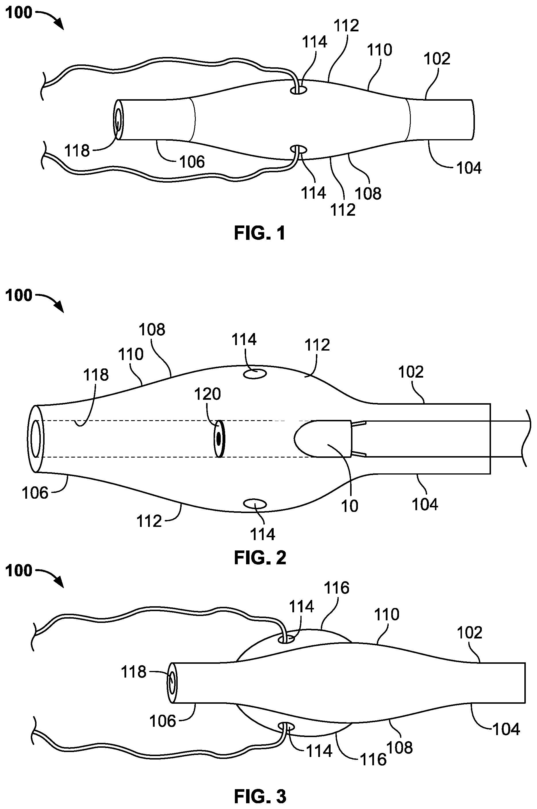 Patent US11793974 Figure 1 – Fixation devices for catheters