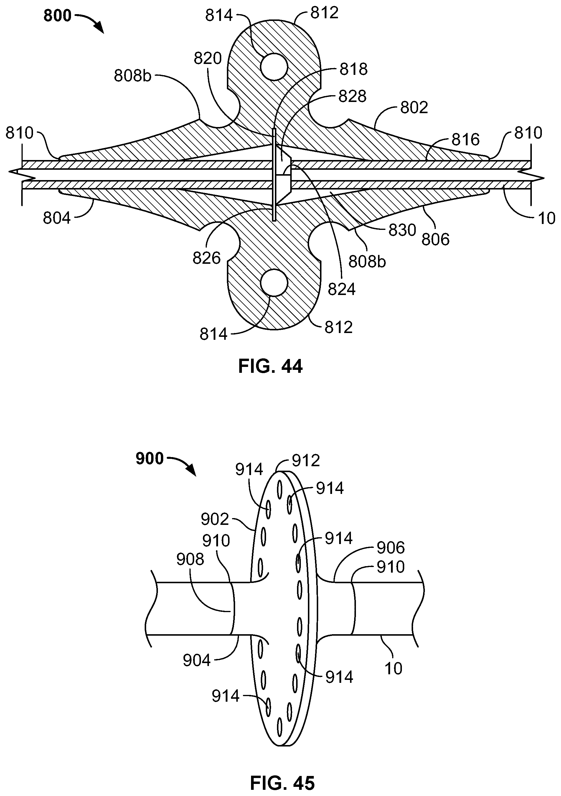 Patent US11793974 Figure 18 – Fixation devices for catheters