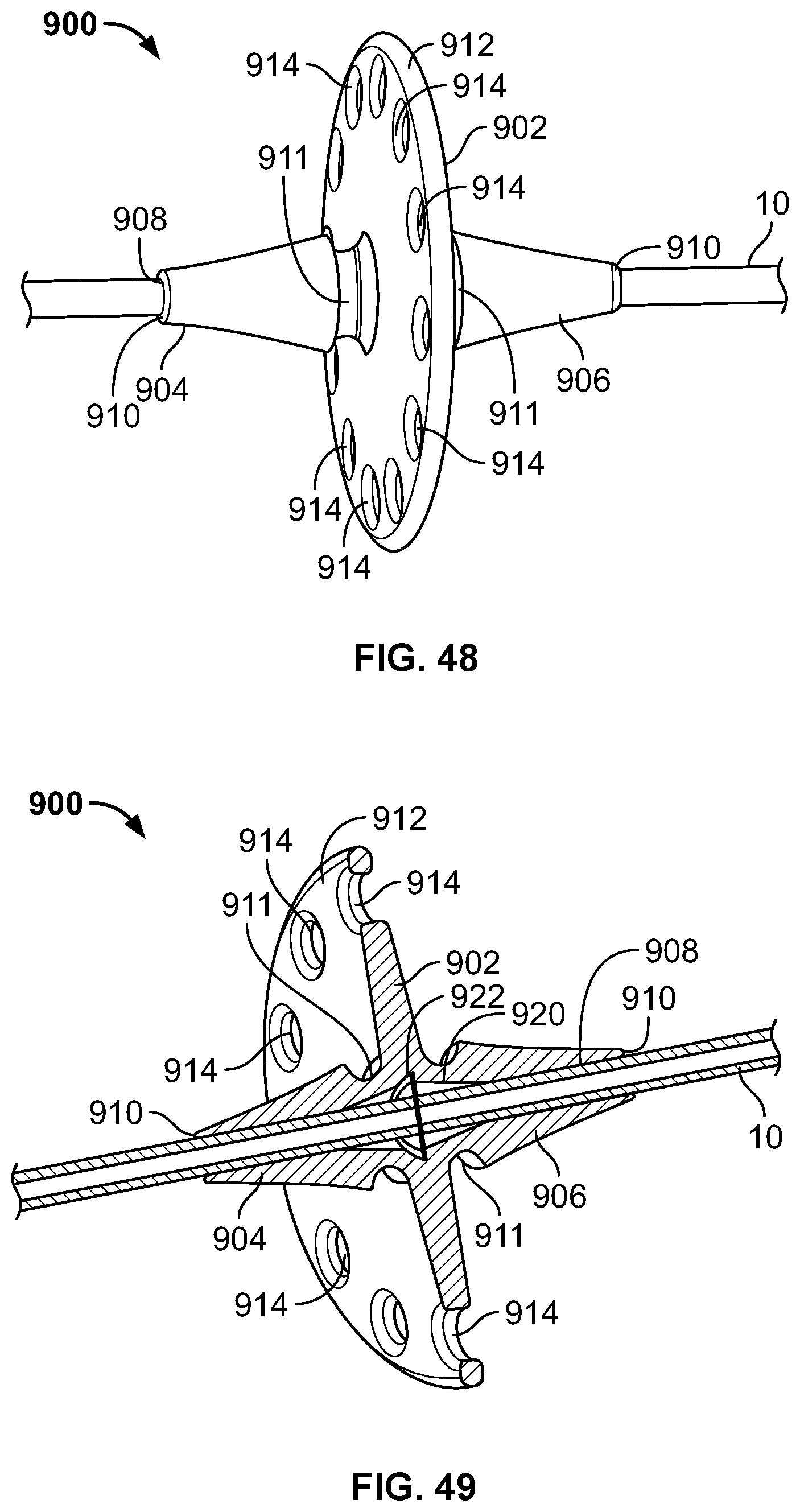 Patent US11793974 Figure 20 – Fixation devices for catheters