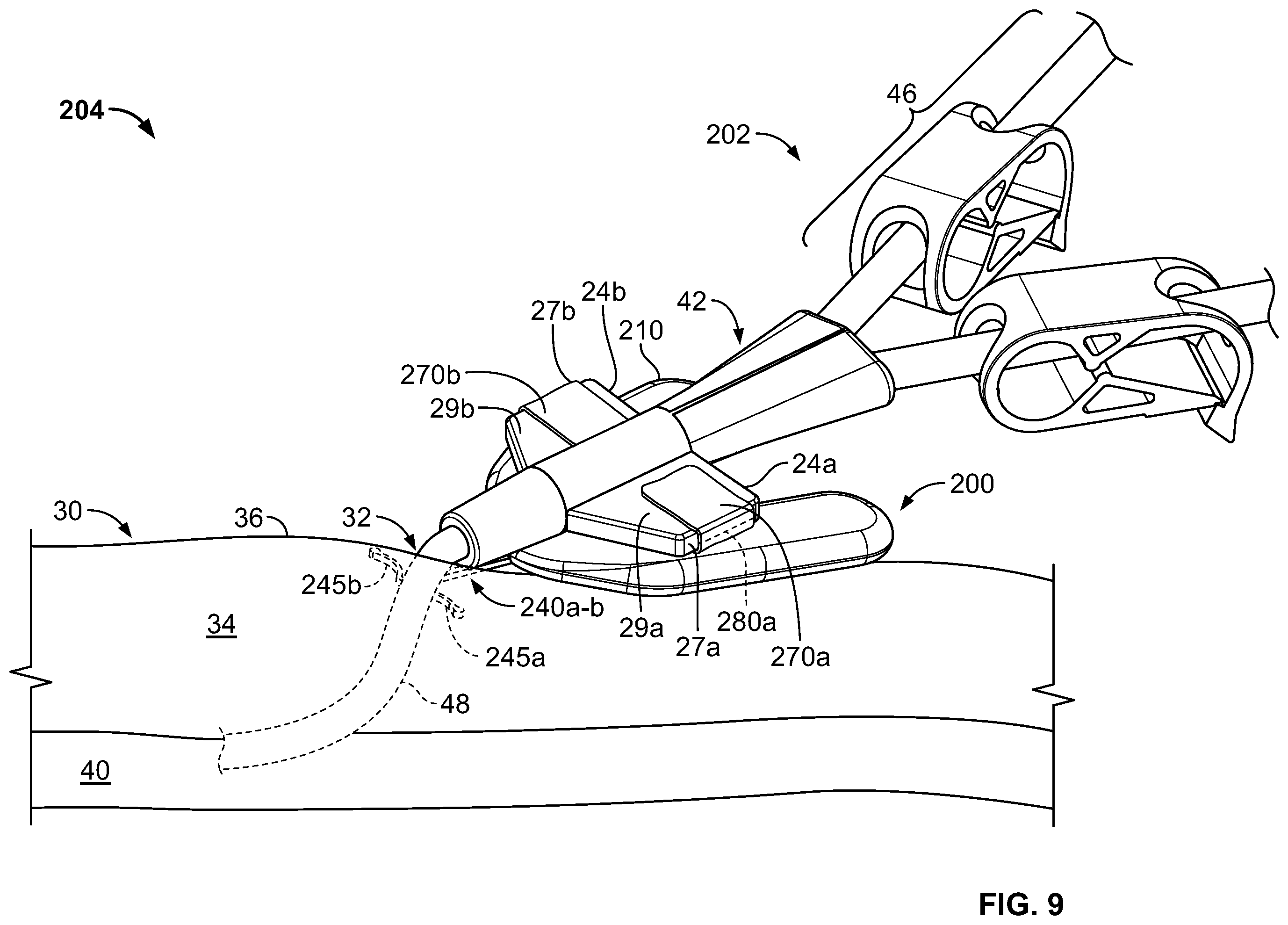 Patent US11793975 Figure 7 – Systems and methods for anchoring medical devices