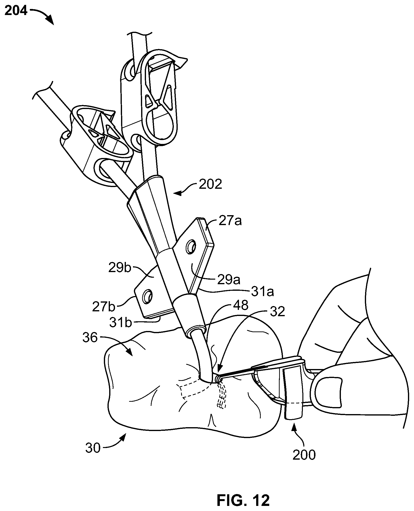Patent US11793975 Figure 10 – Systems and methods for anchoring medical devices