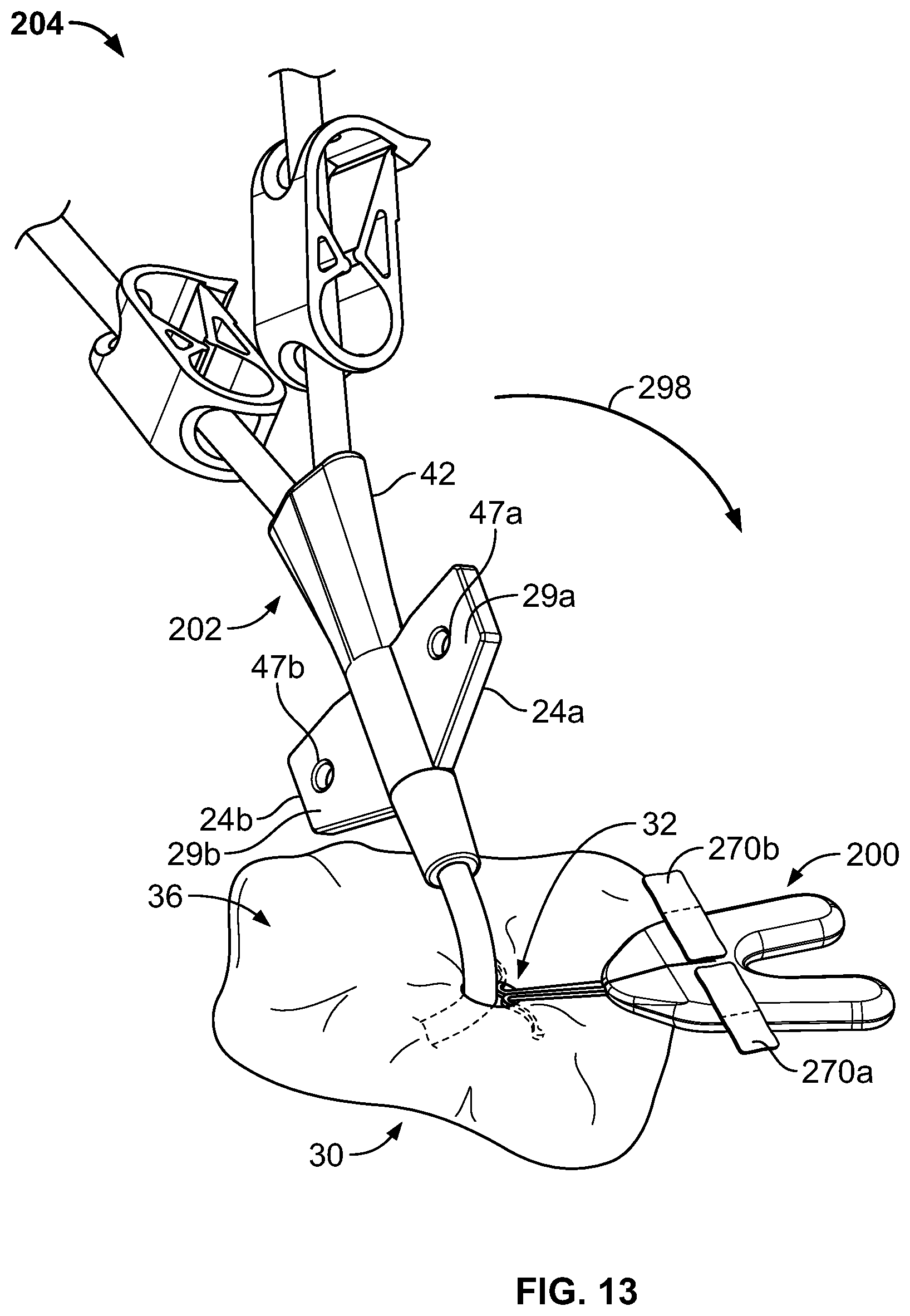 Patent US11793975 Figure 11 – Systems and methods for anchoring medical devices