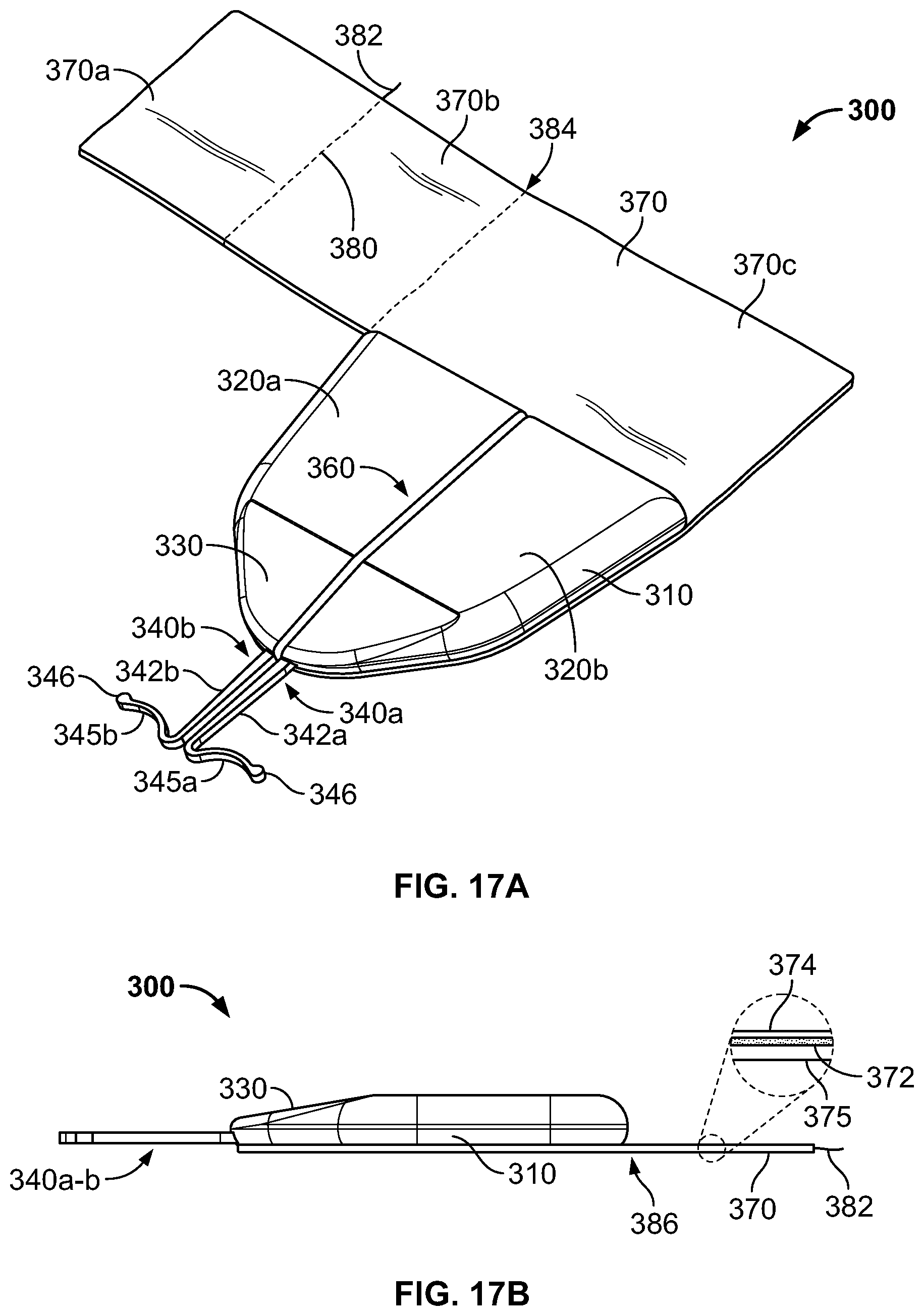 Patent US11793975 Figure 14 – Systems and methods for anchoring medical devices