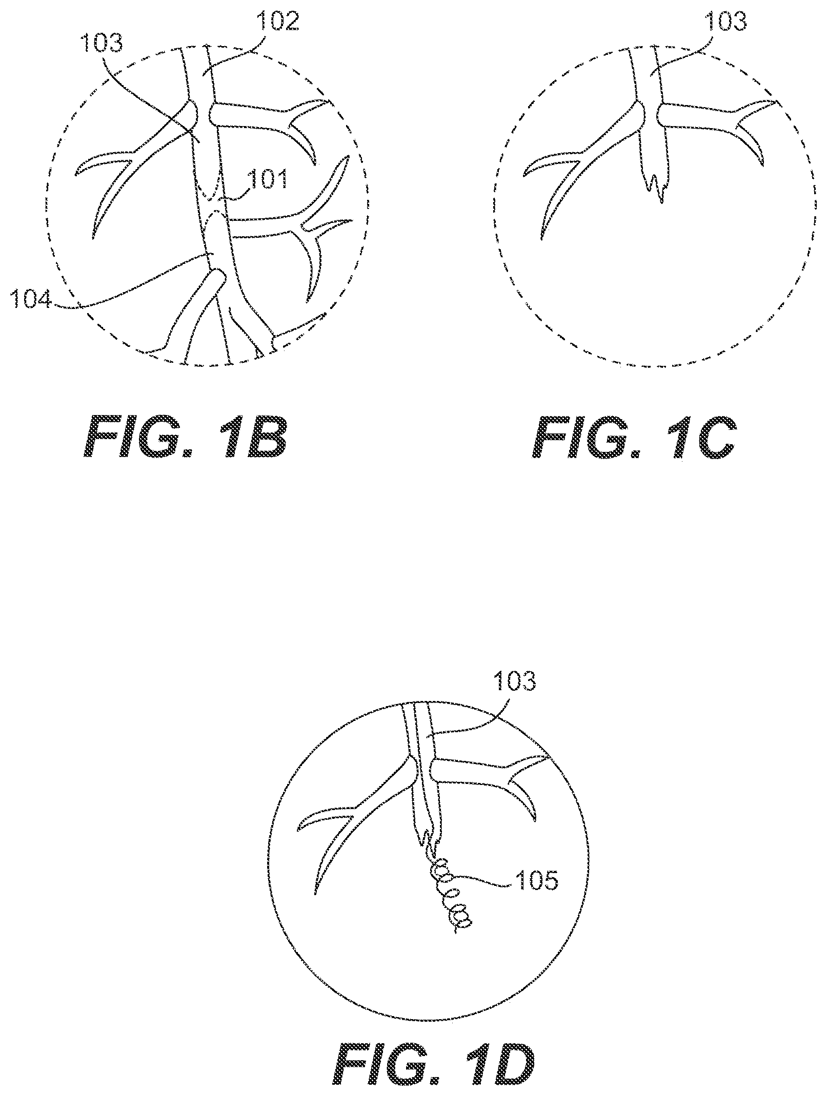 Patent US11793978 Figure 2 – Endovascular devices and methods