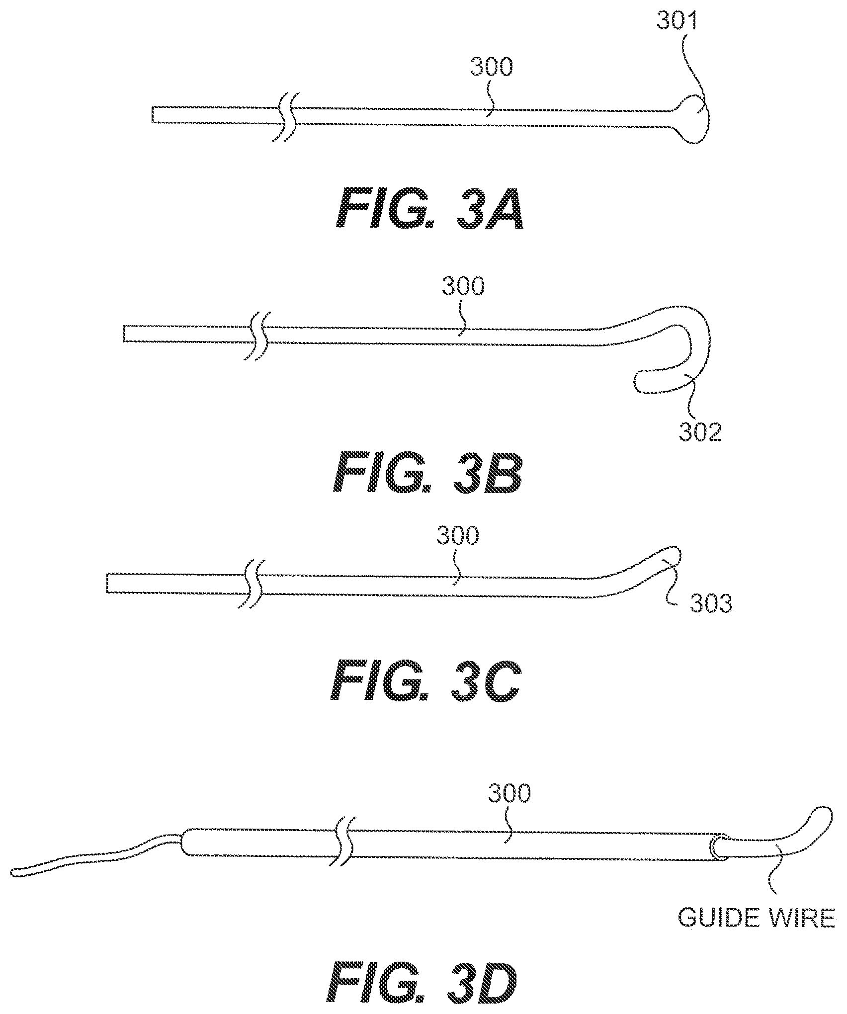 Patent US11793978 Figure 4 – Endovascular devices and methods