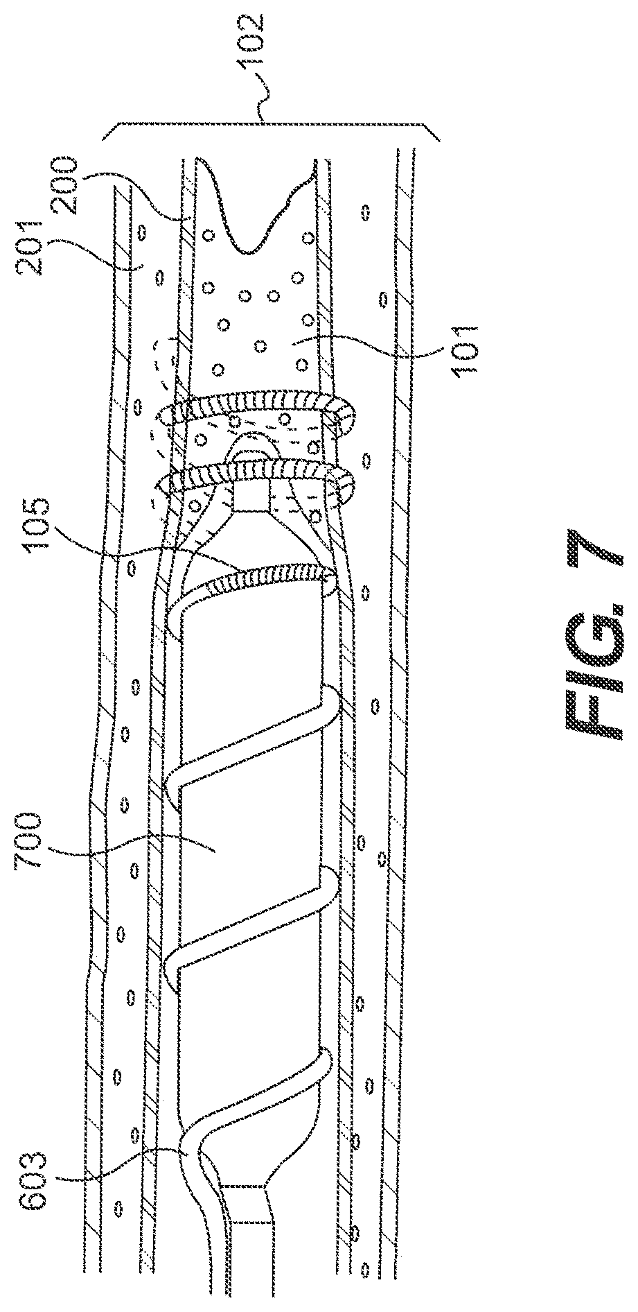 Patent US11793978 Figure 9 – Endovascular devices and methods