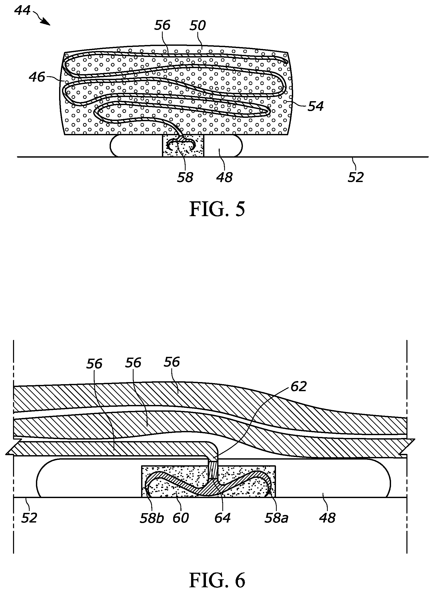 Patent US11793980 Figure 3 – Intestinal attachment device