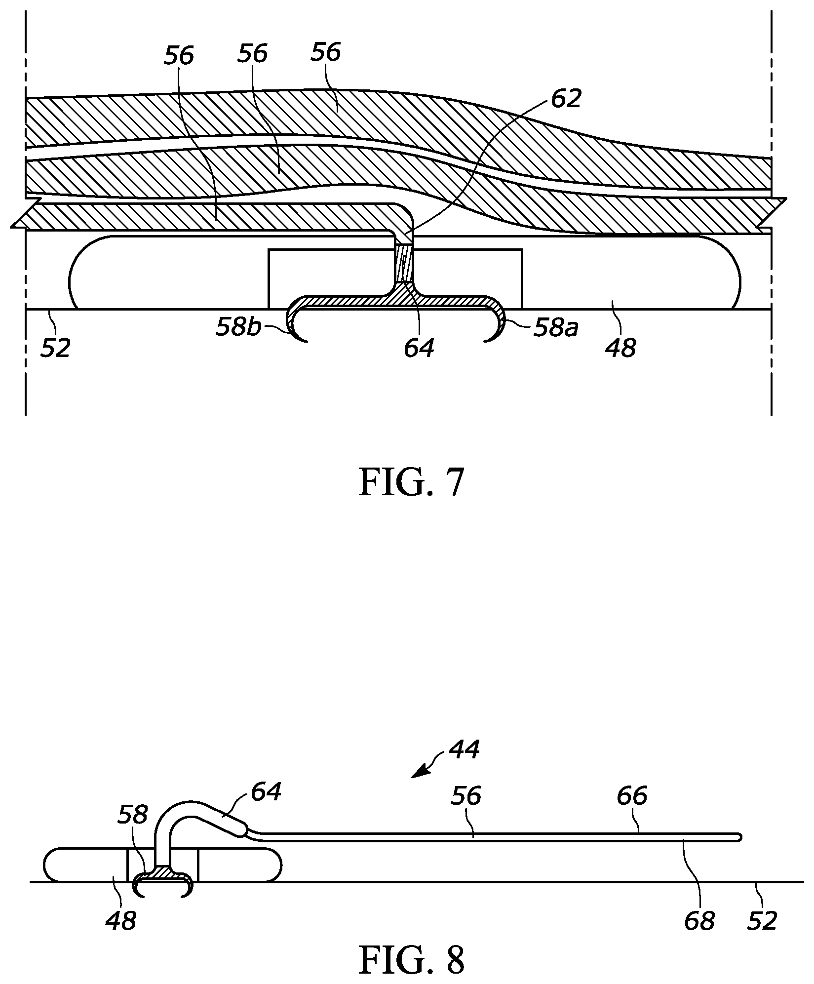 Patent US11793980 Figure 4 – Intestinal attachment device