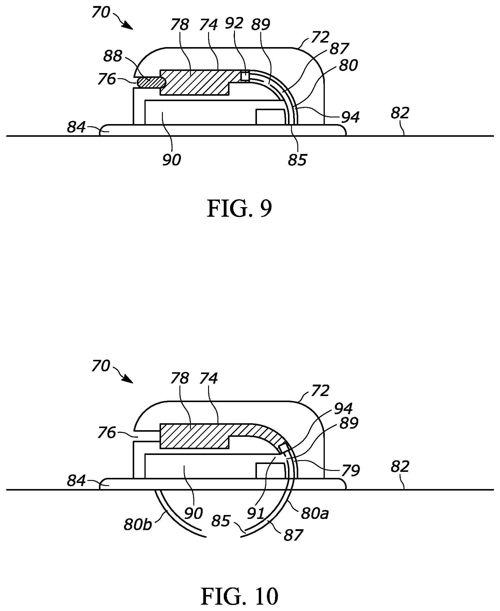 Patent US11793980 Figure 5 – Intestinal attachment device