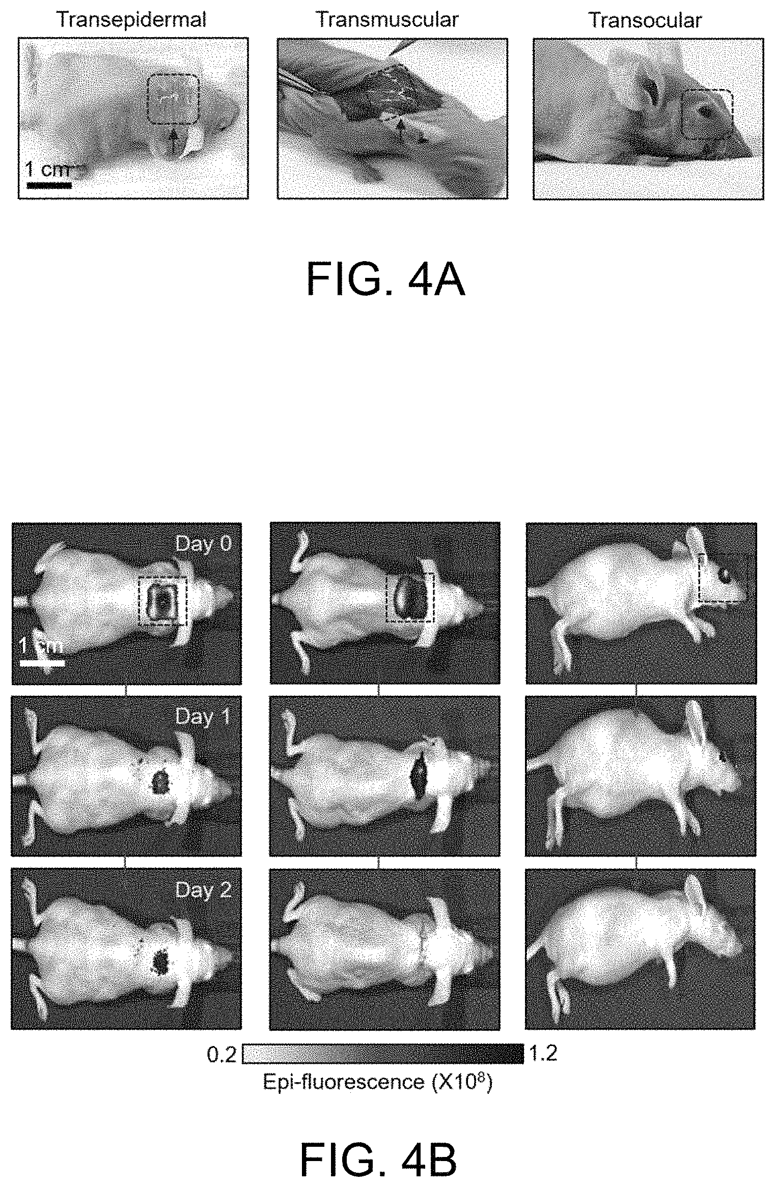 Patent US11793982 Figure 4 – Drug delivery devices and methods of fabrication and use therefor