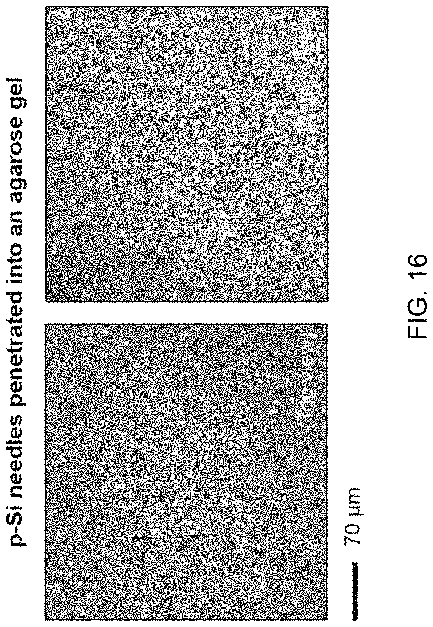 Patent US11793982 Figure 16 – Drug delivery devices and methods of fabrication and use therefor