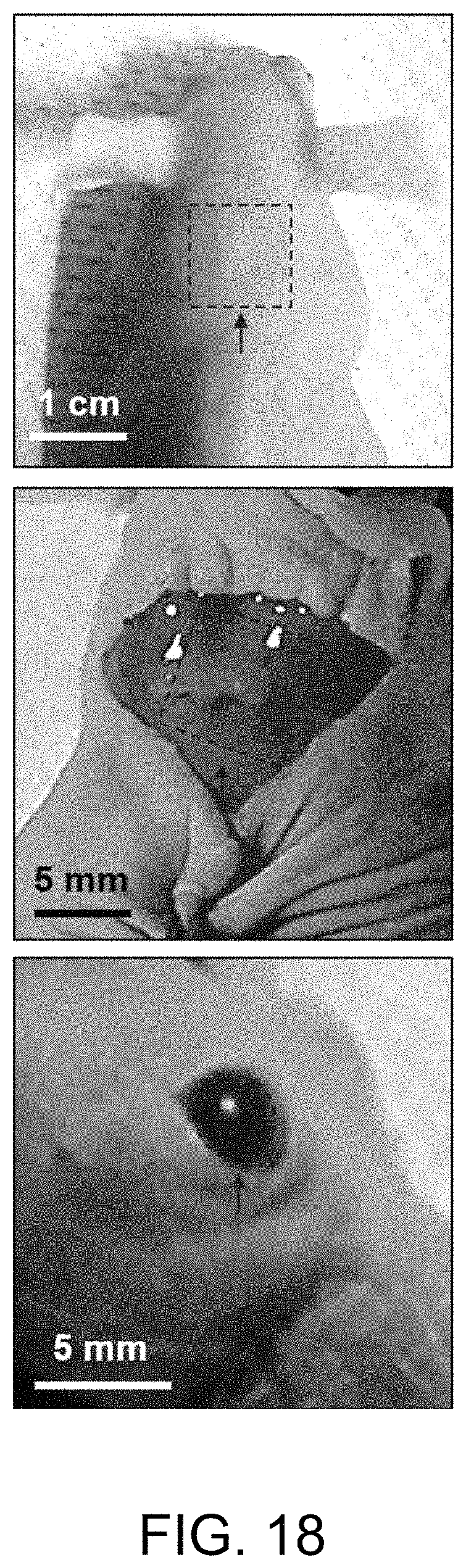 Patent US11793982 Figure 18 – Drug delivery devices and methods of fabrication and use therefor
