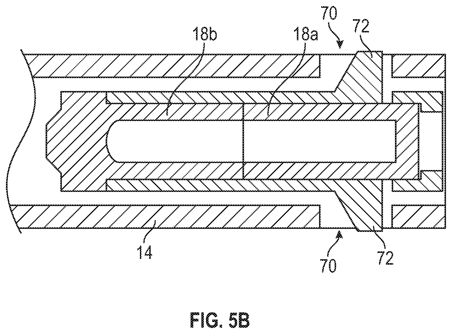 Patent US11793986 Figure 11 – Septum housing