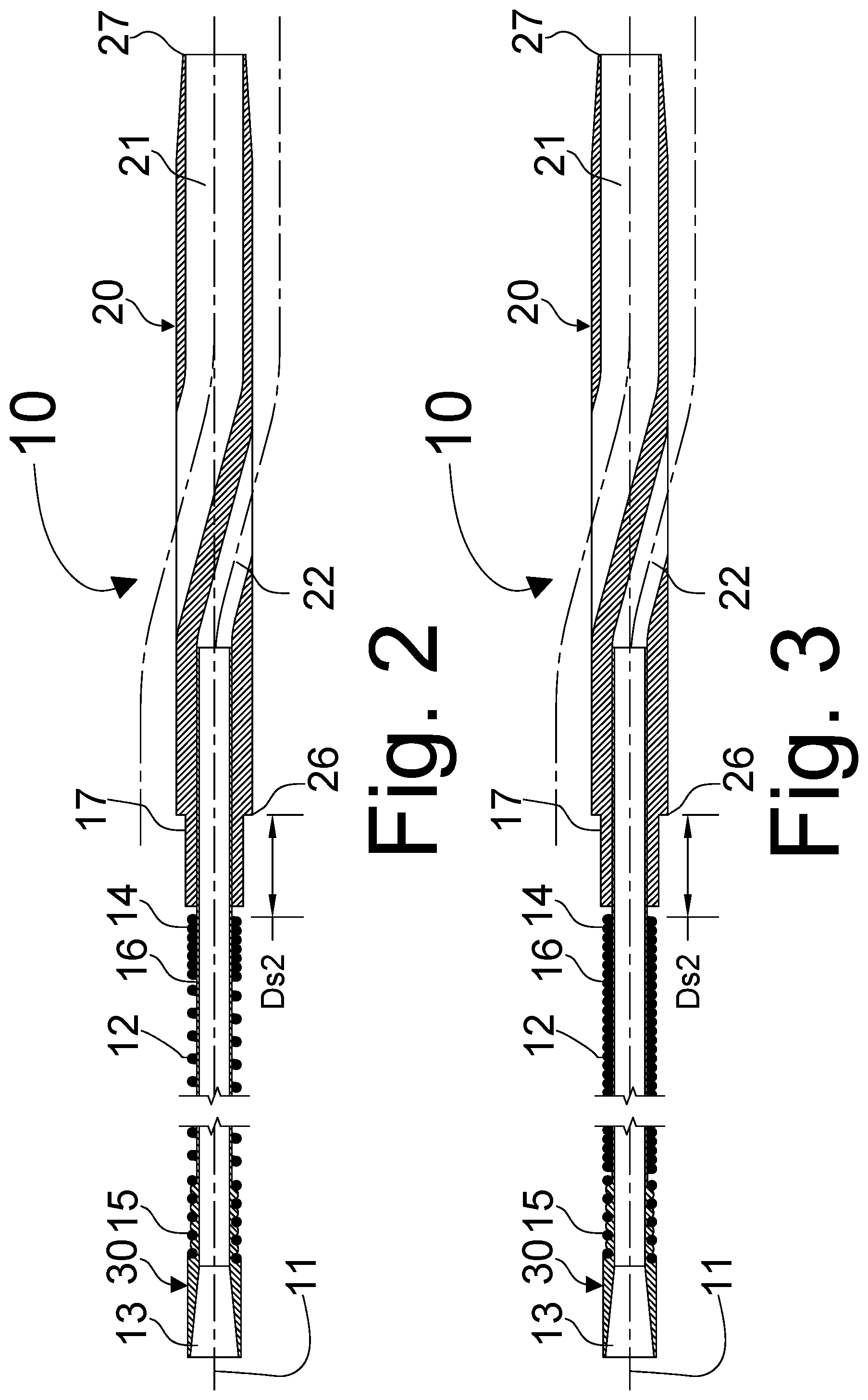 Patent US11793988 Figure 2 – Modular medical device catheter system
