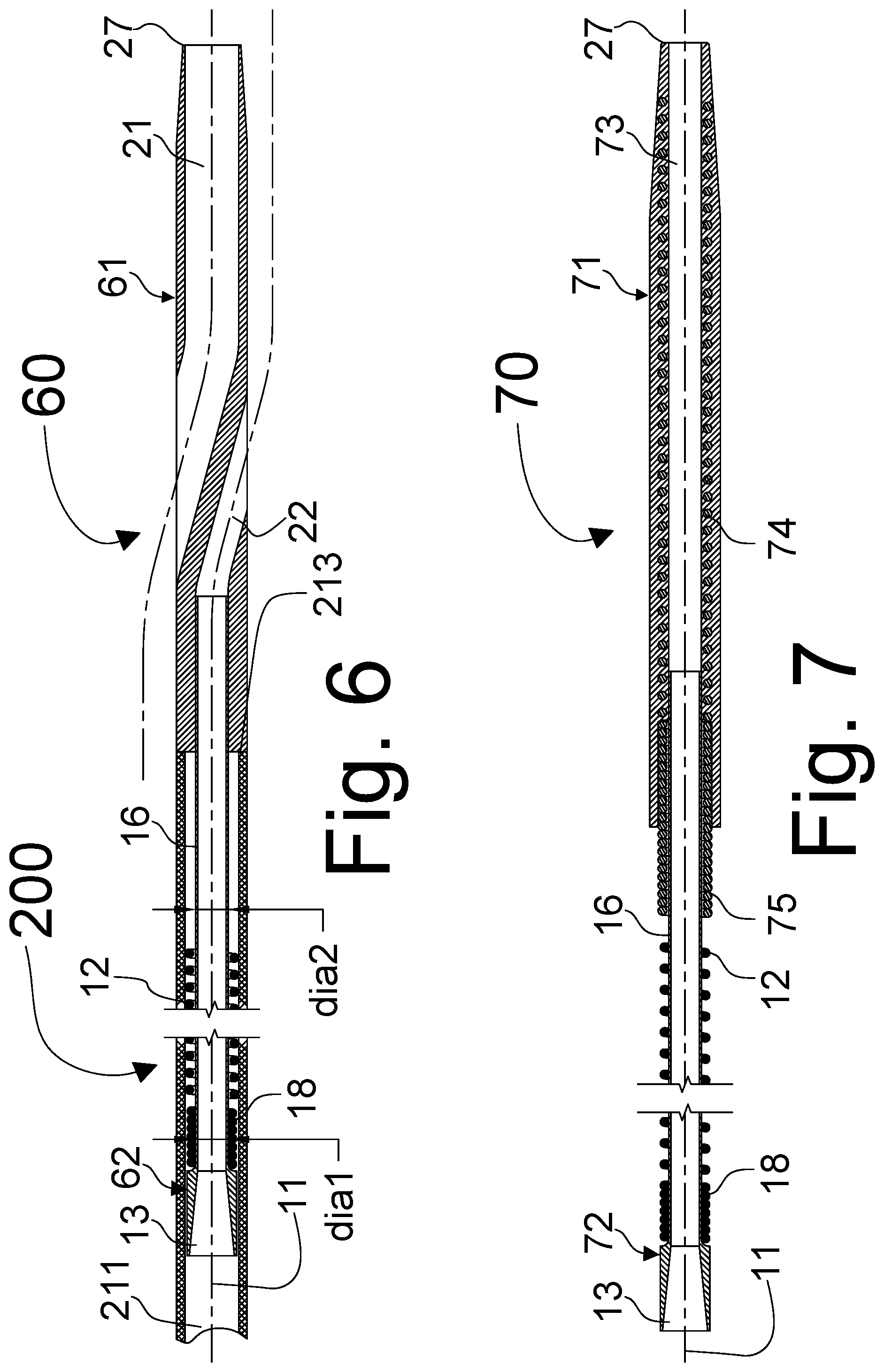 Patent US11793988 Figure 4 – Modular medical device catheter system