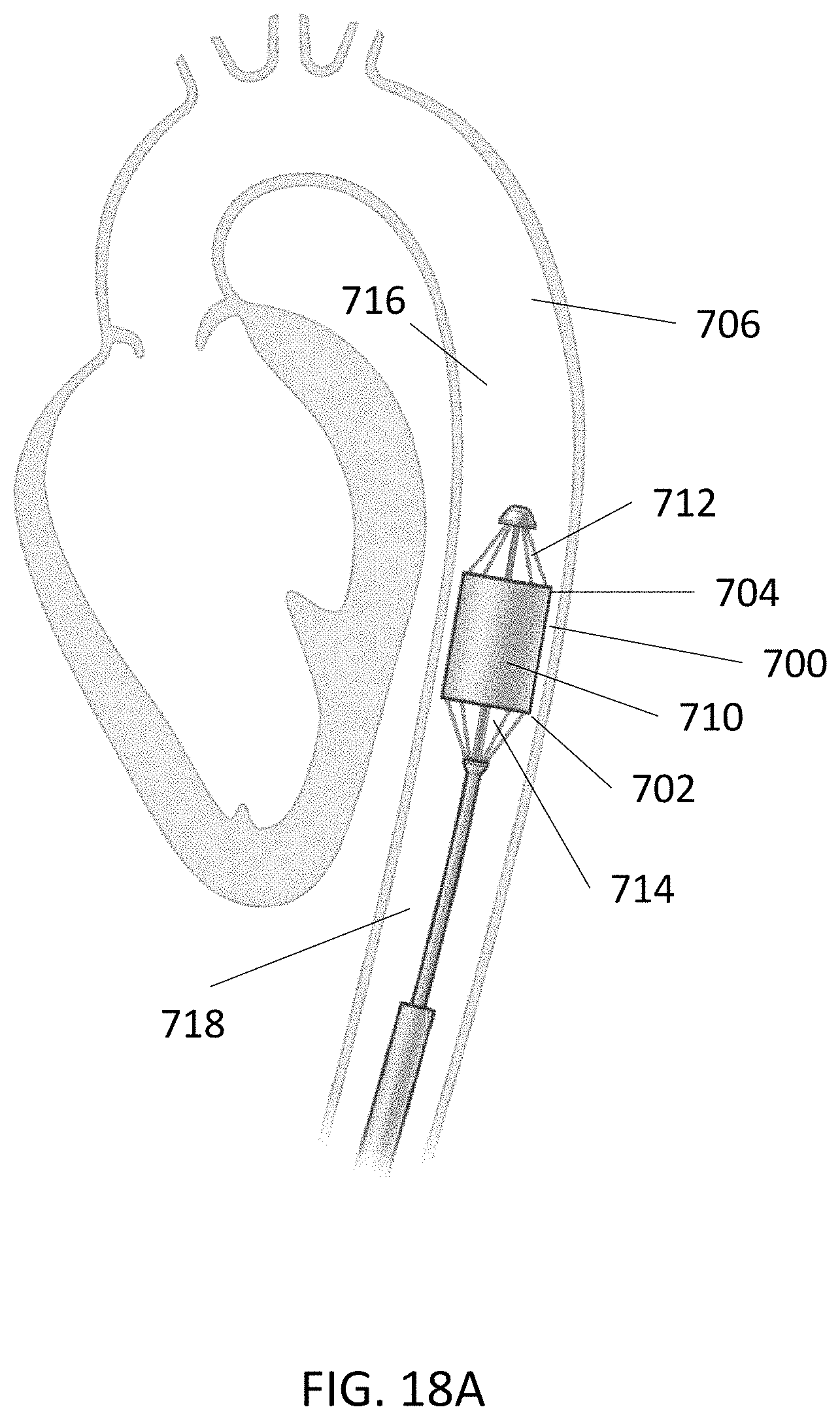 Patent US11793991 Figure 18 – Linear cardiac assist pulsatile pump