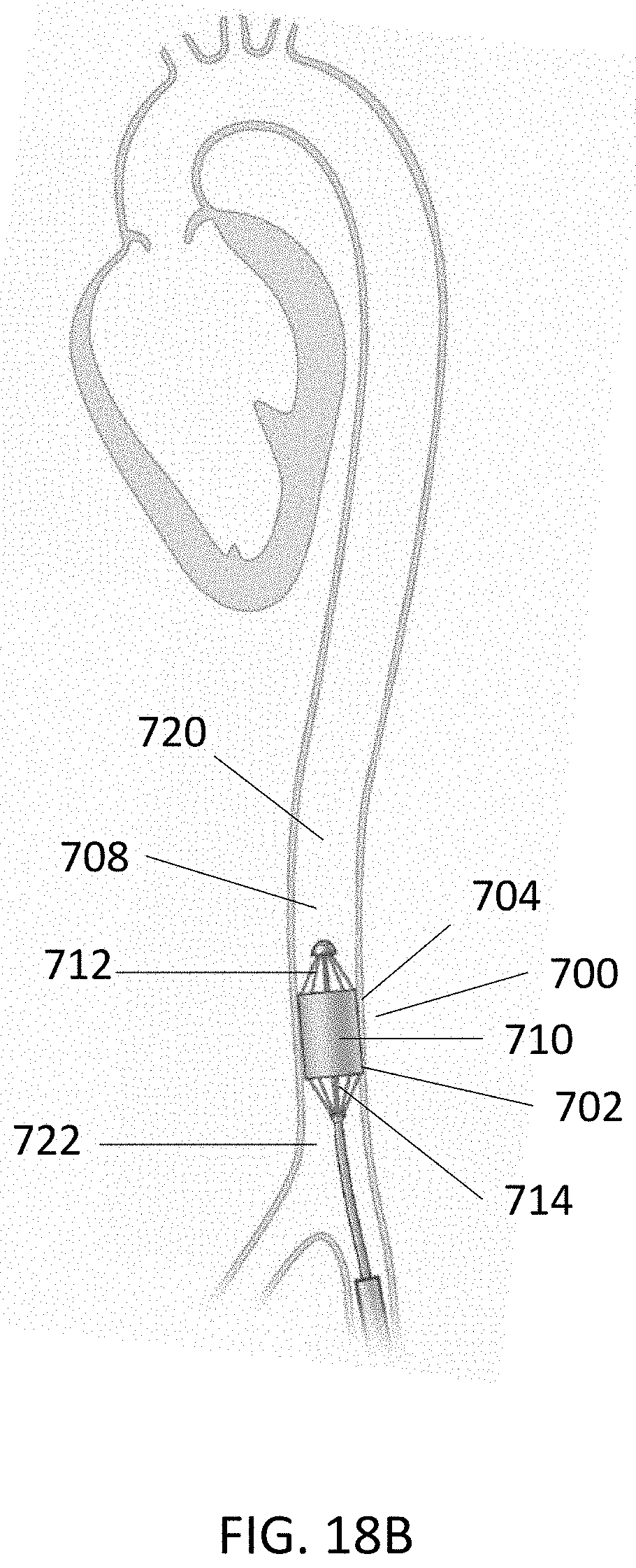 Patent US11793991 Figure 19 – Linear cardiac assist pulsatile pump
