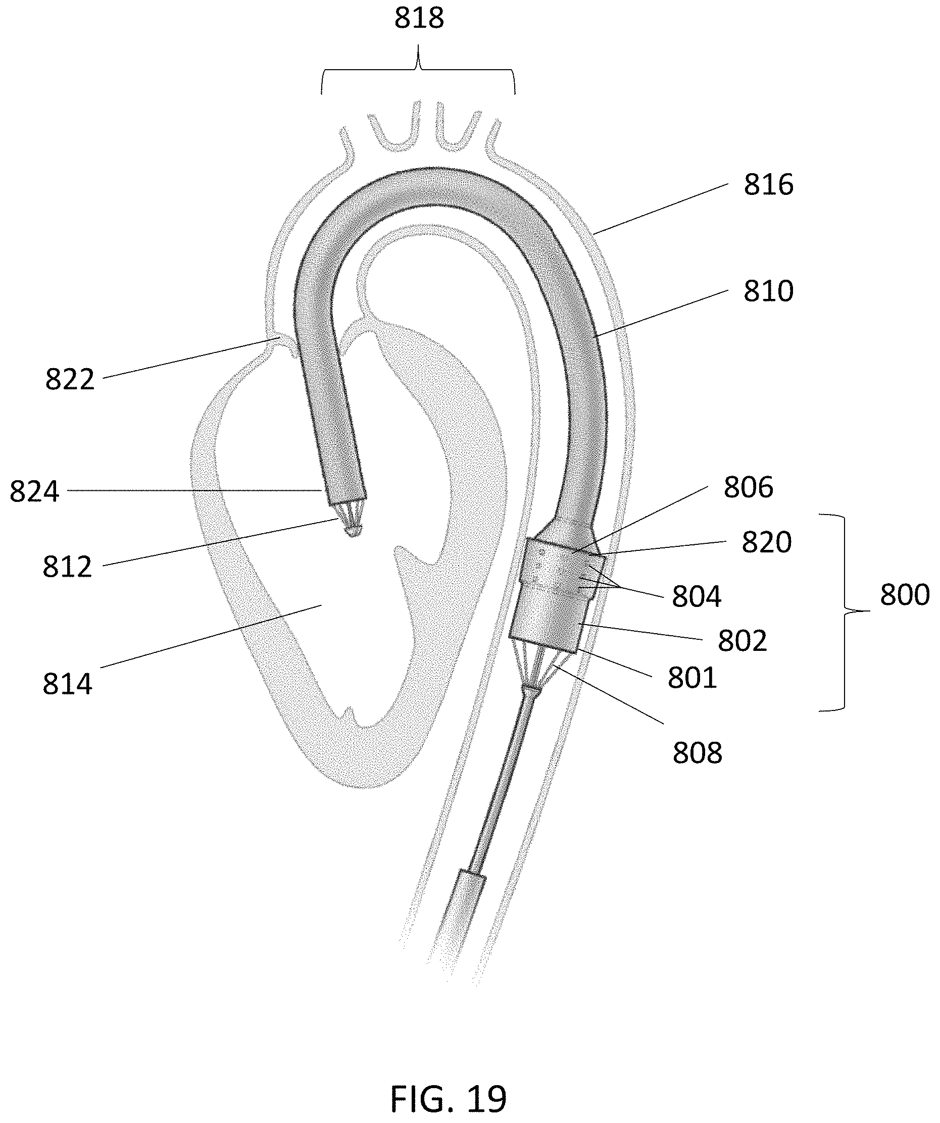 Patent US11793991 Figure 20 – Linear cardiac assist pulsatile pump