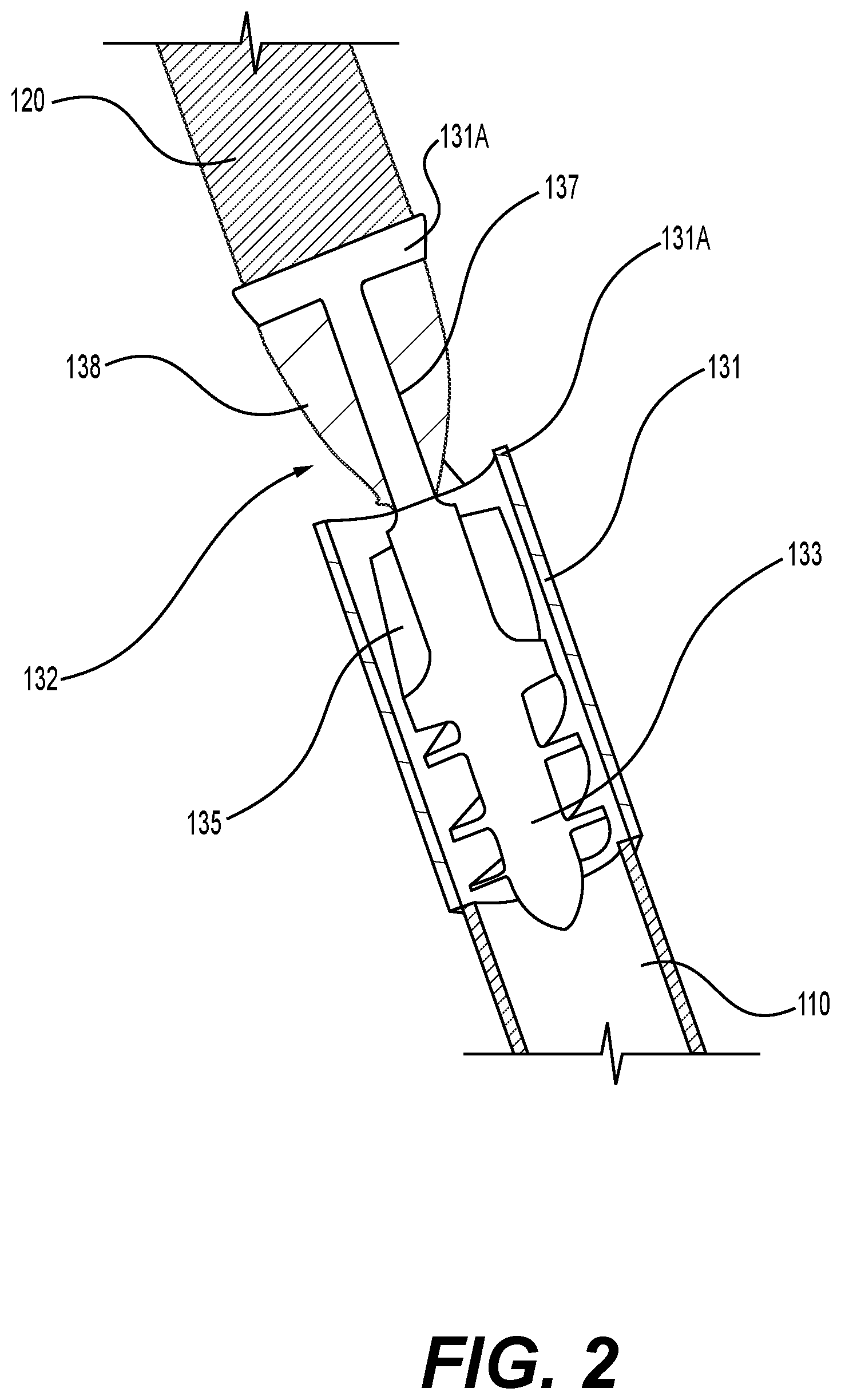 Patent US11793992 Figure 2 – Systems and methods for pump-assisted blood circulation