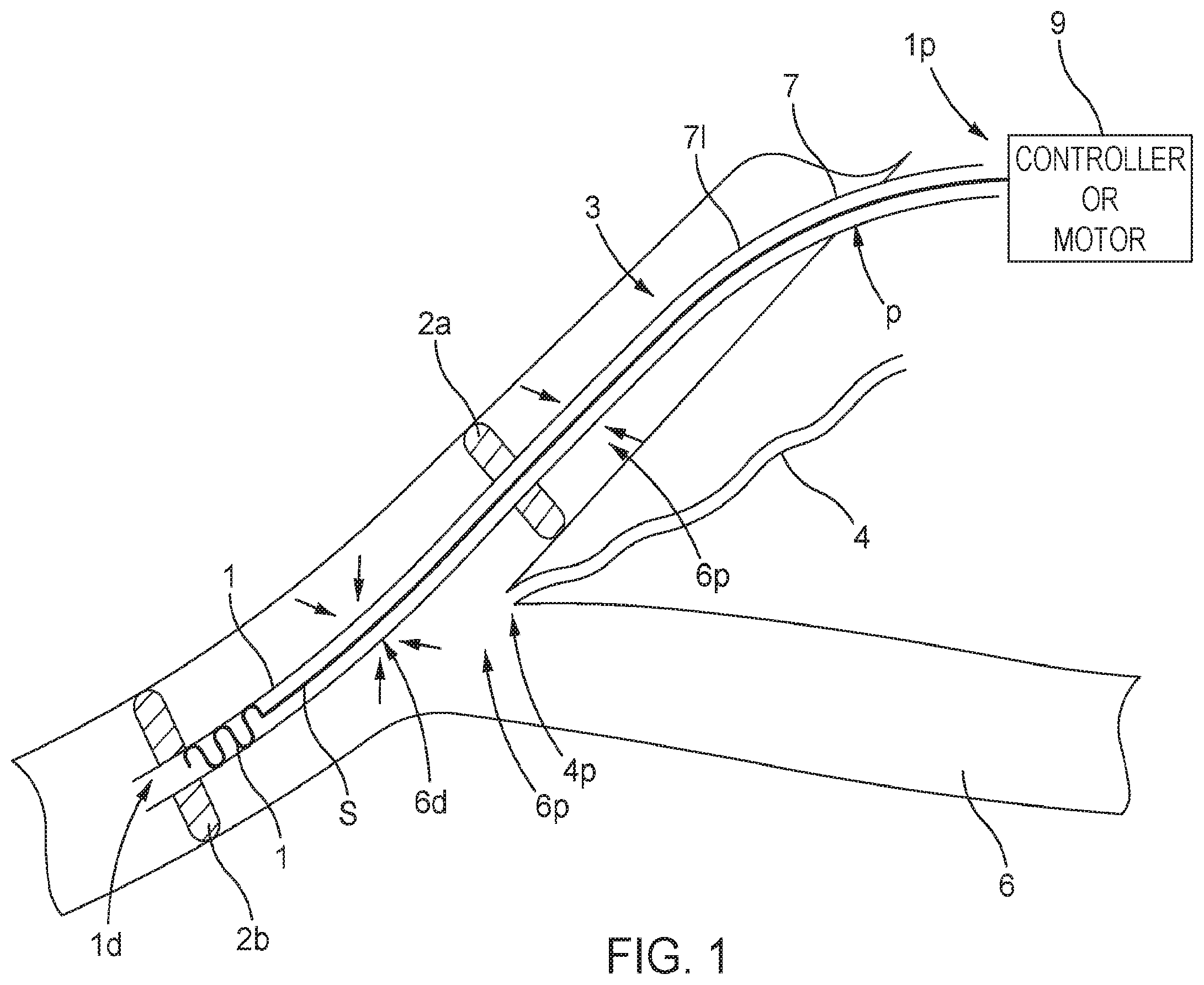 Patent US11793995 Figure 1 – Systems and methods for reducing pressure at an outflow of a duct