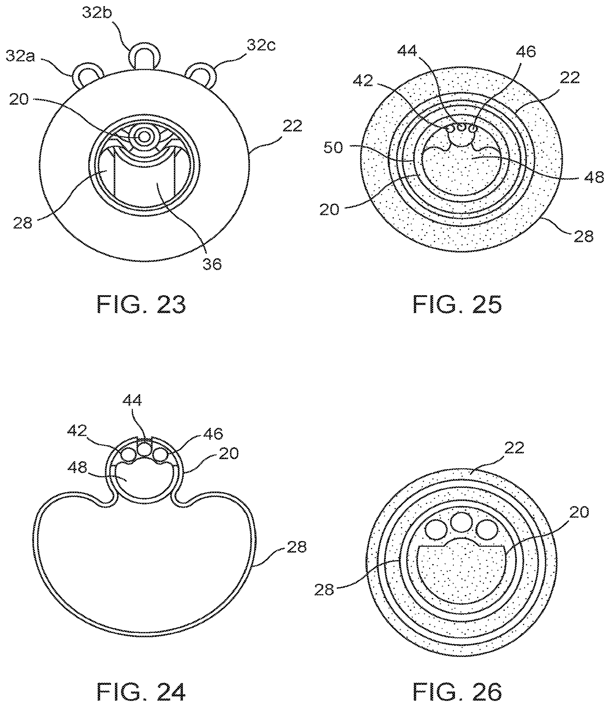 Patent US11793995 Figure 12 – Systems and methods for reducing pressure at an outflow of a duct