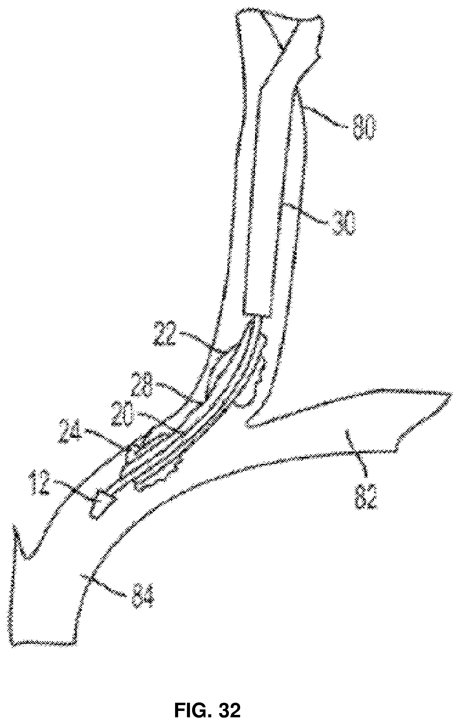 Patent US11793995 Figure 17 – Systems and methods for reducing pressure at an outflow of a duct