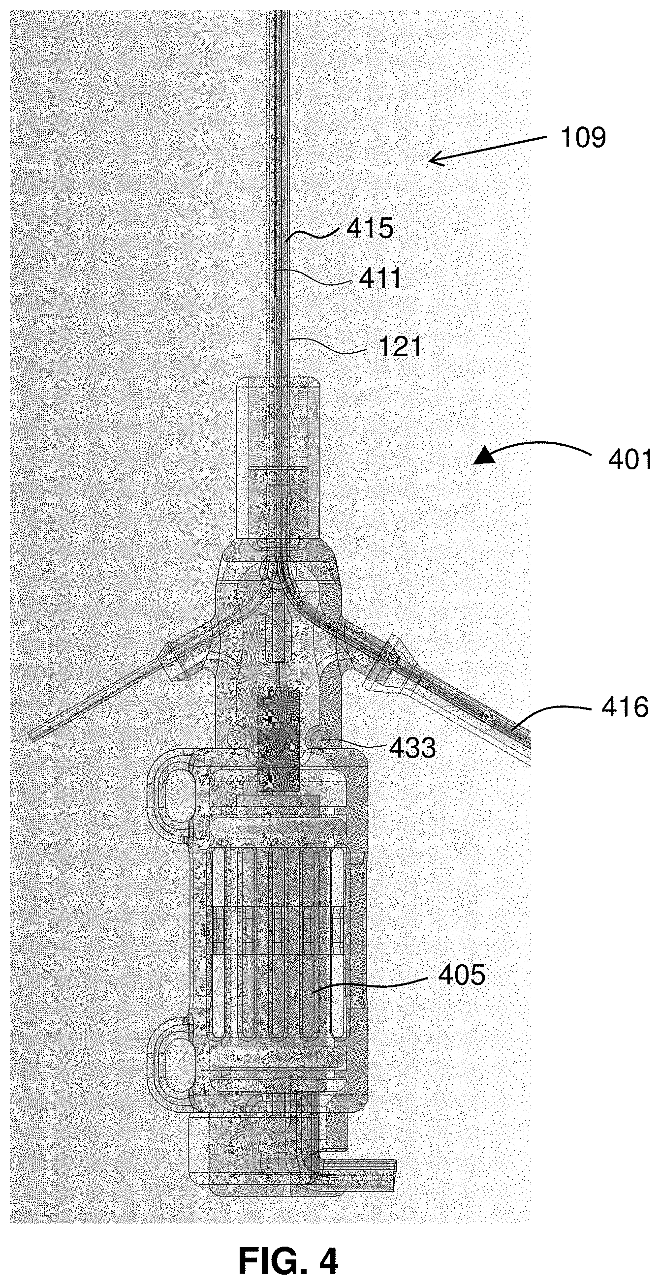 Patent US11793996 Figure 4 – Devices and methods for treating edema