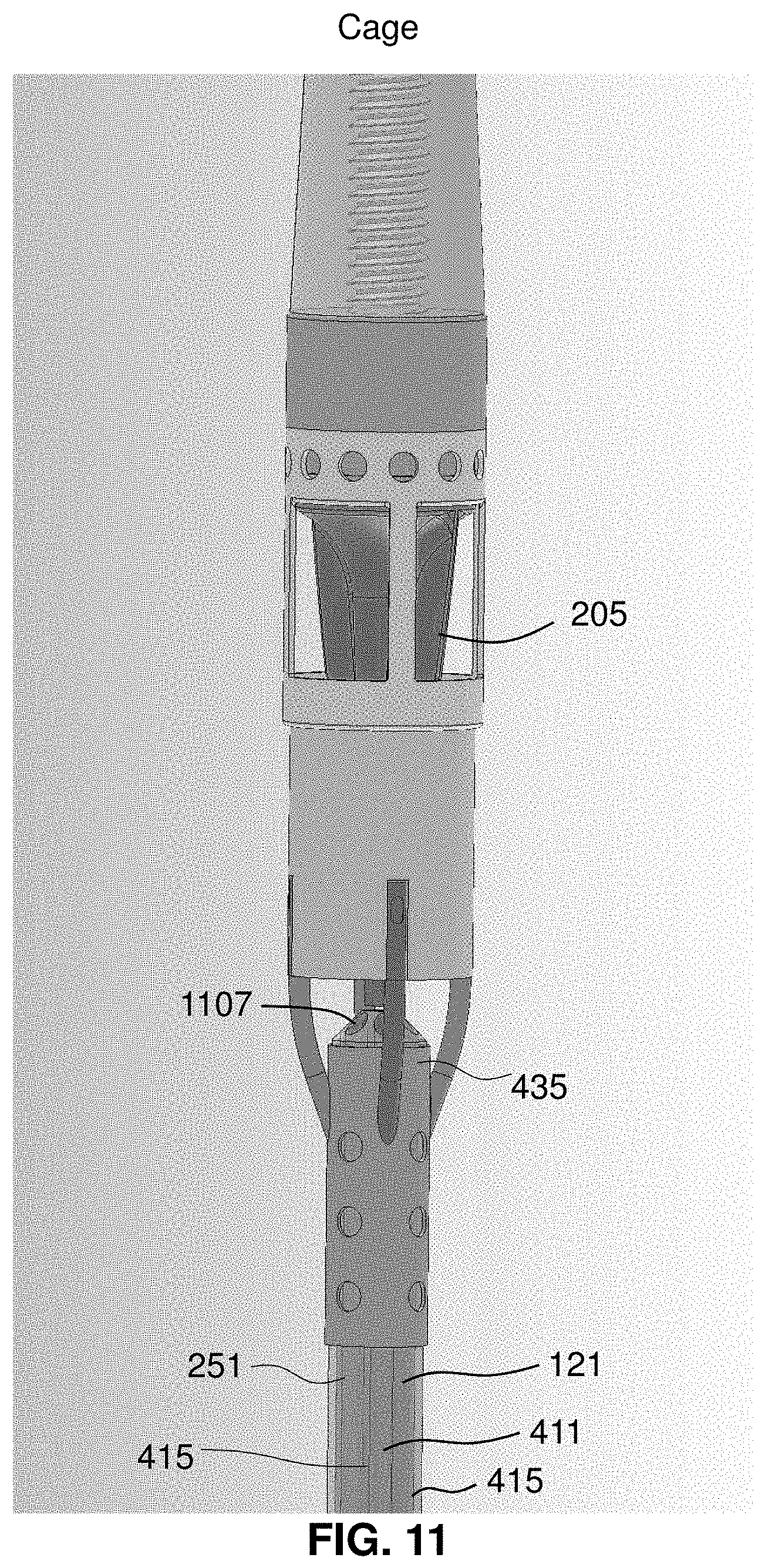Patent US11793996 Figure 11 – Devices and methods for treating edema
