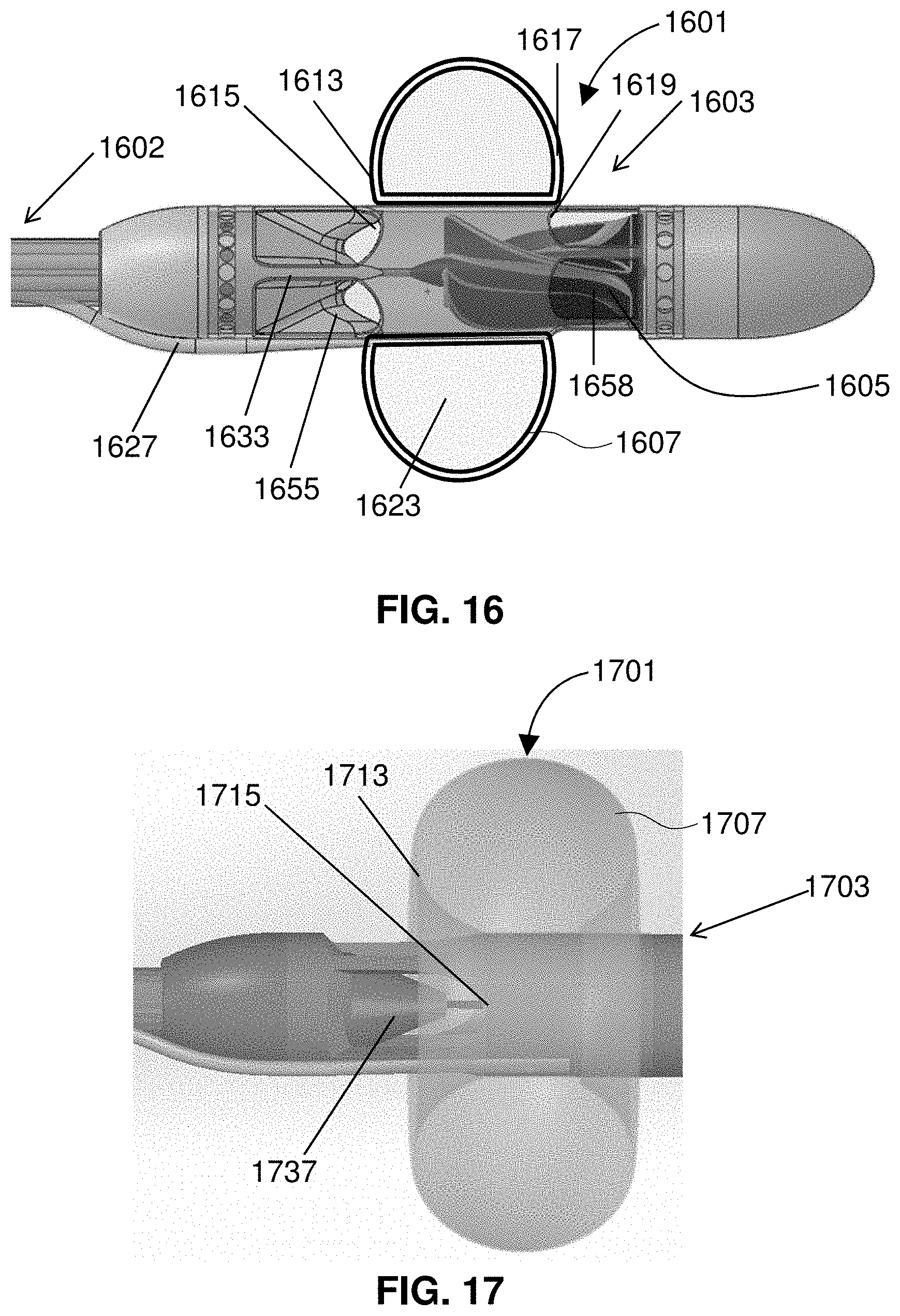 Patent US11793996 Figure 16 – Devices and methods for treating edema