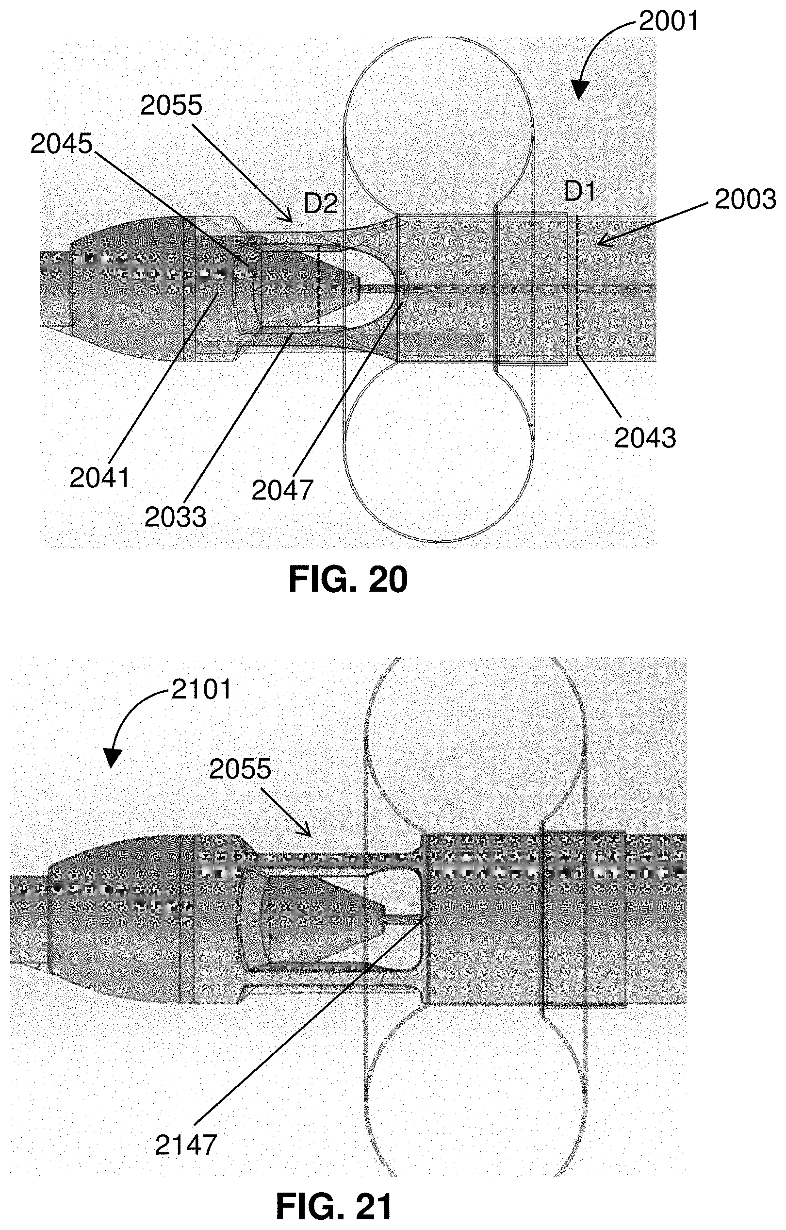 Patent US11793996 Figure 18 – Devices and methods for treating edema