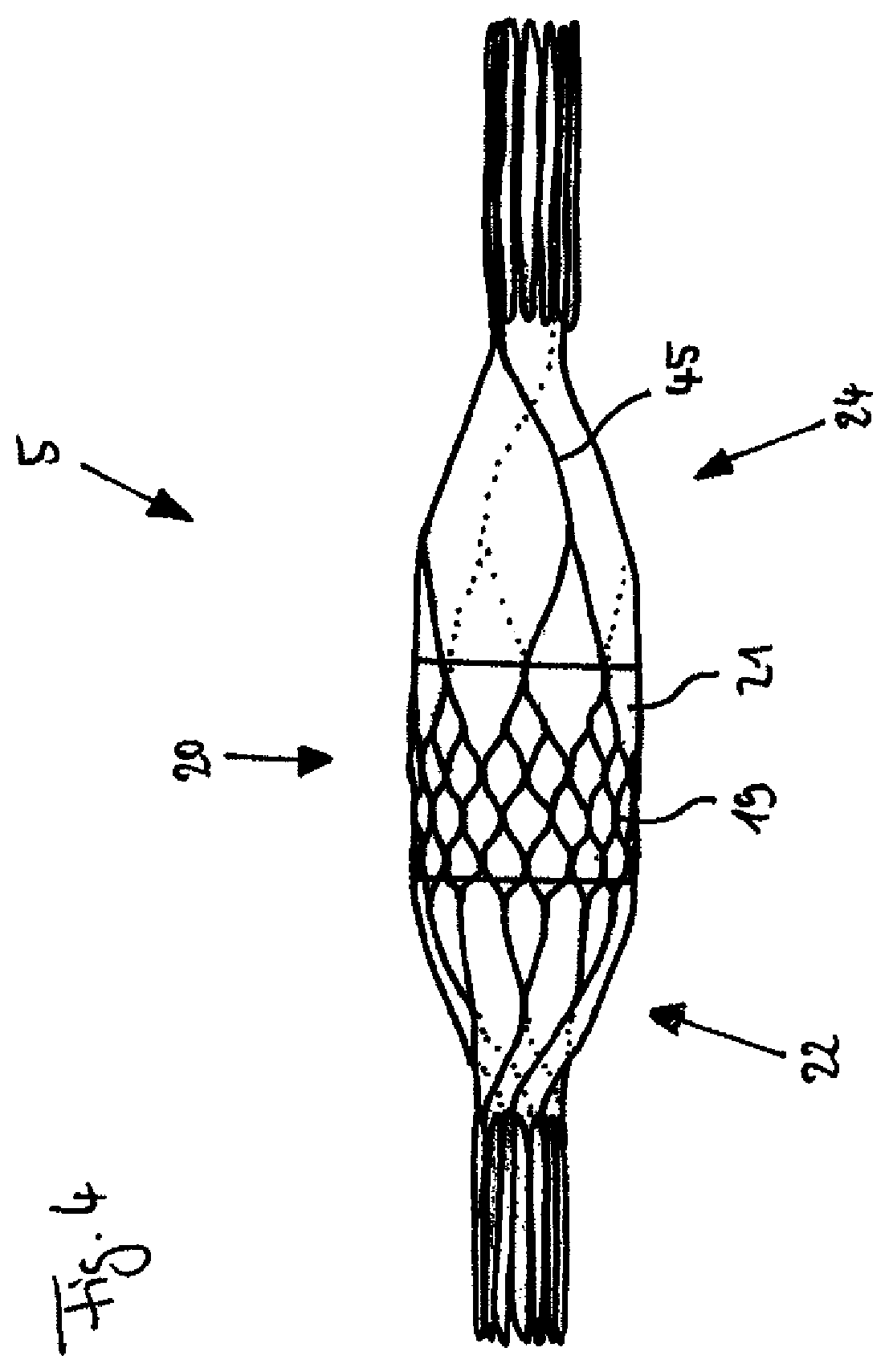 Patent US11793997 Figure 4 – Pump, in particular a blood pump