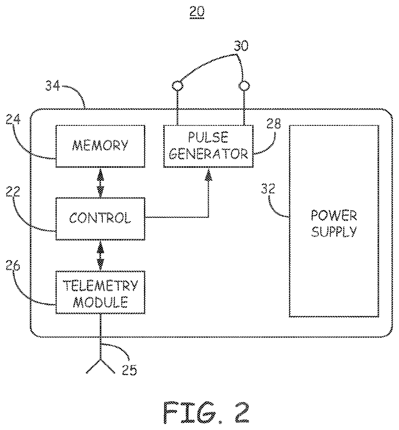 Patent US11793998 Figure 4 – Minimally invasive implantable neurostimulation system