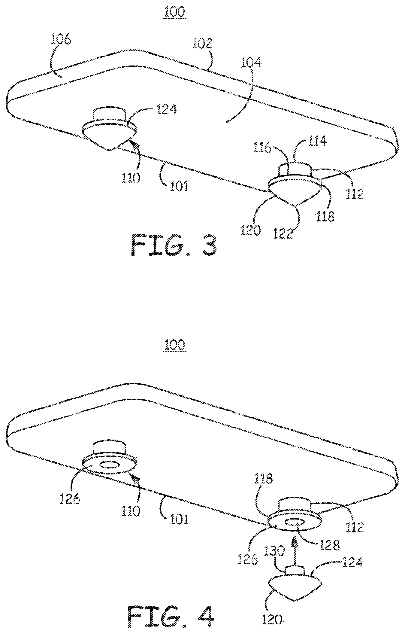Patent US11793998 Figure 5 – Minimally invasive implantable neurostimulation system