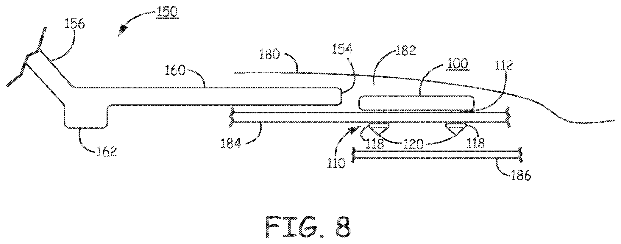 Patent US11793998 Figure 8 – Minimally invasive implantable neurostimulation system