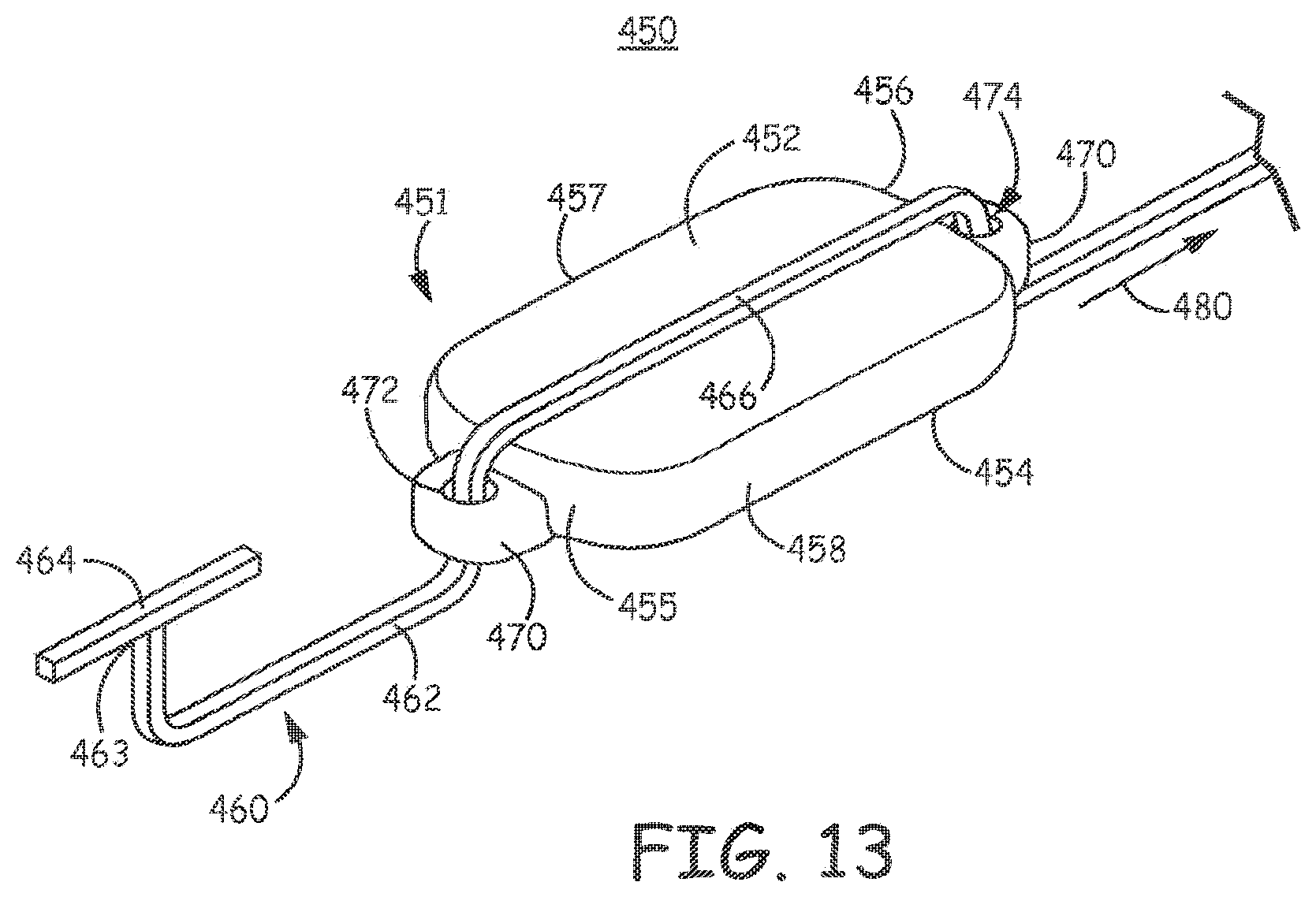 Patent US11793998 Figure 11 – Minimally invasive implantable neurostimulation system