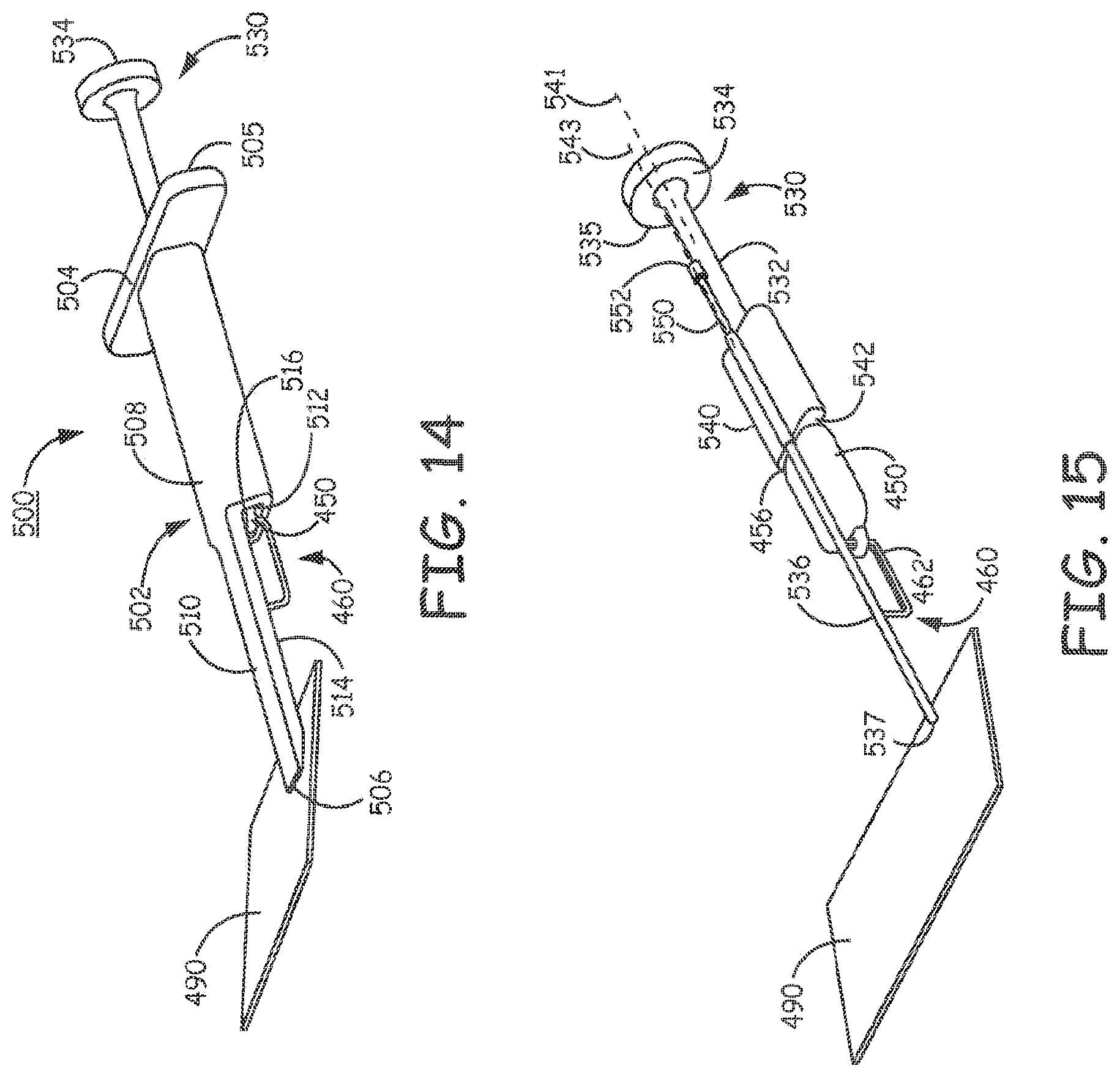 Patent US11793998 Figure 12 – Minimally invasive implantable neurostimulation system