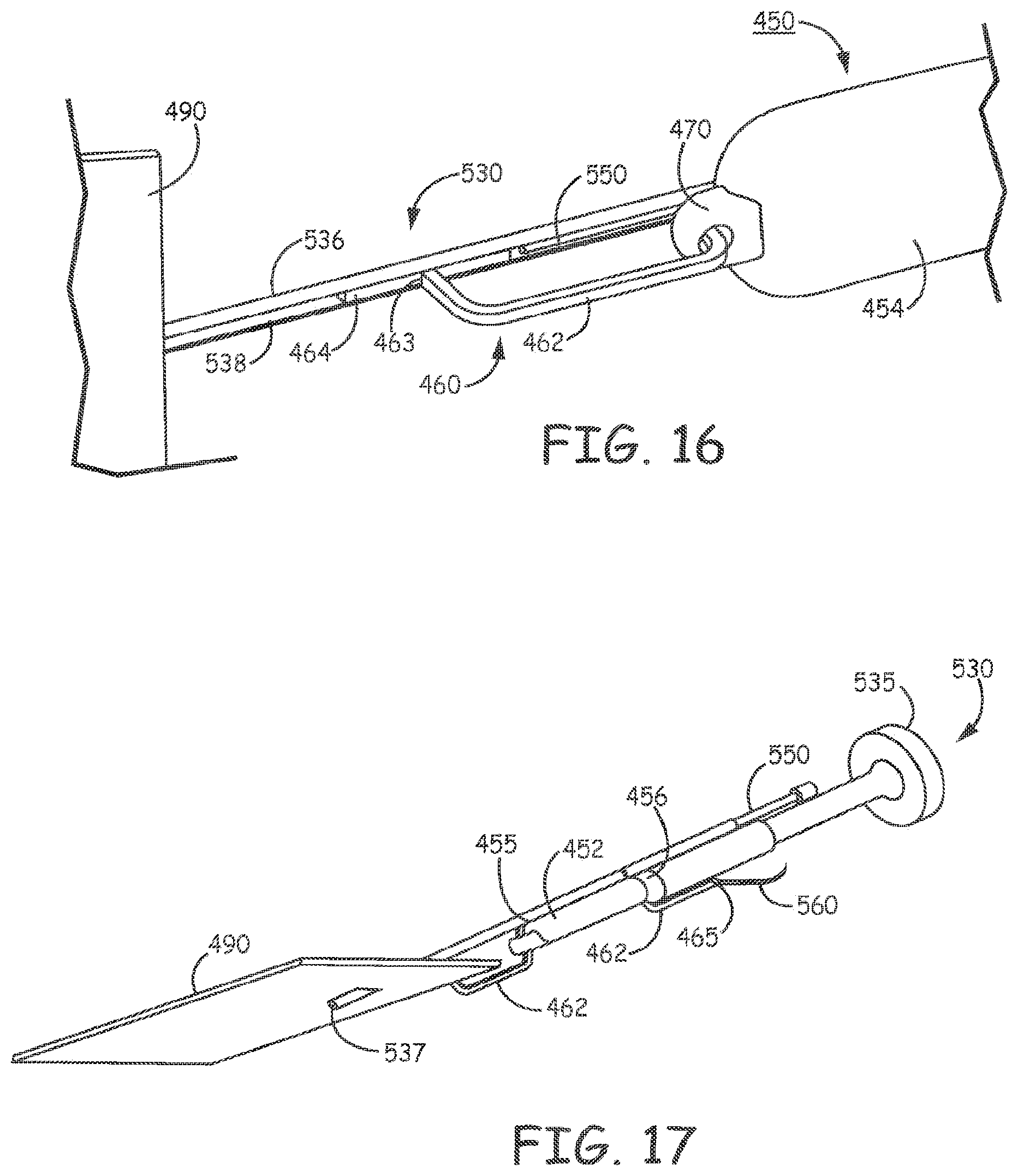 Patent US11793998 Figure 13 – Minimally invasive implantable neurostimulation system