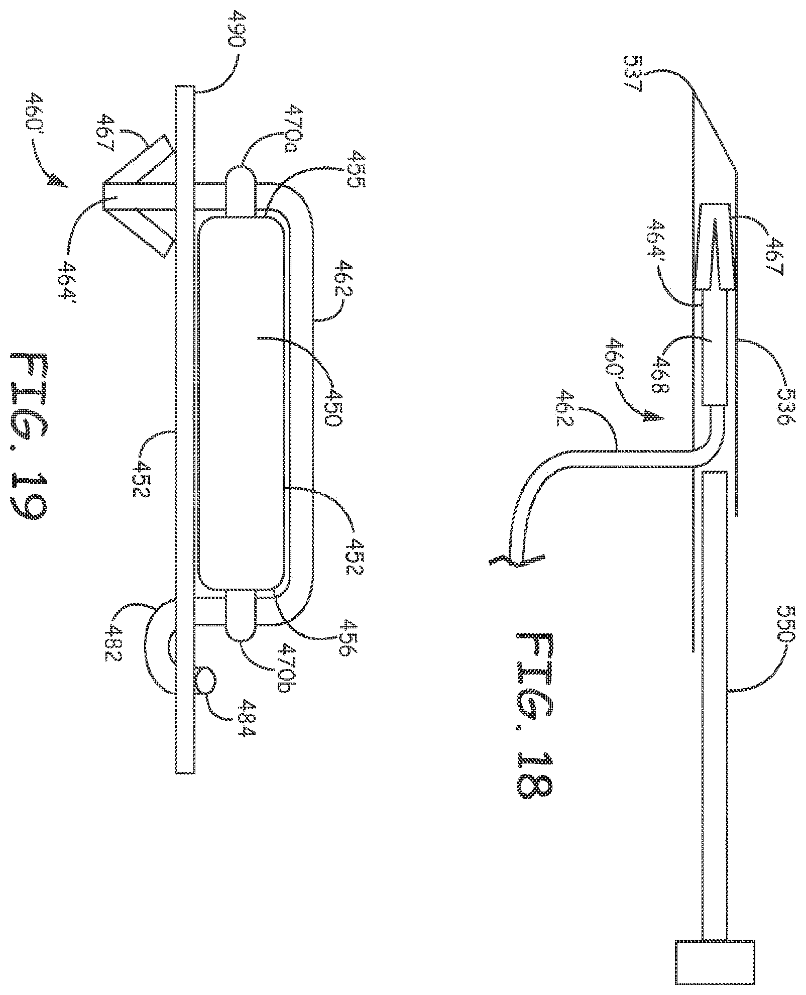 Patent US11793998 Figure 14 – Minimally invasive implantable neurostimulation system