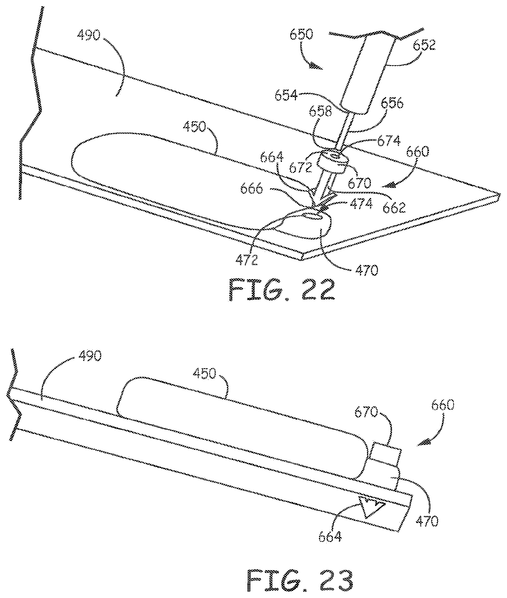 Patent US11793998 Figure 16 – Minimally invasive implantable neurostimulation system