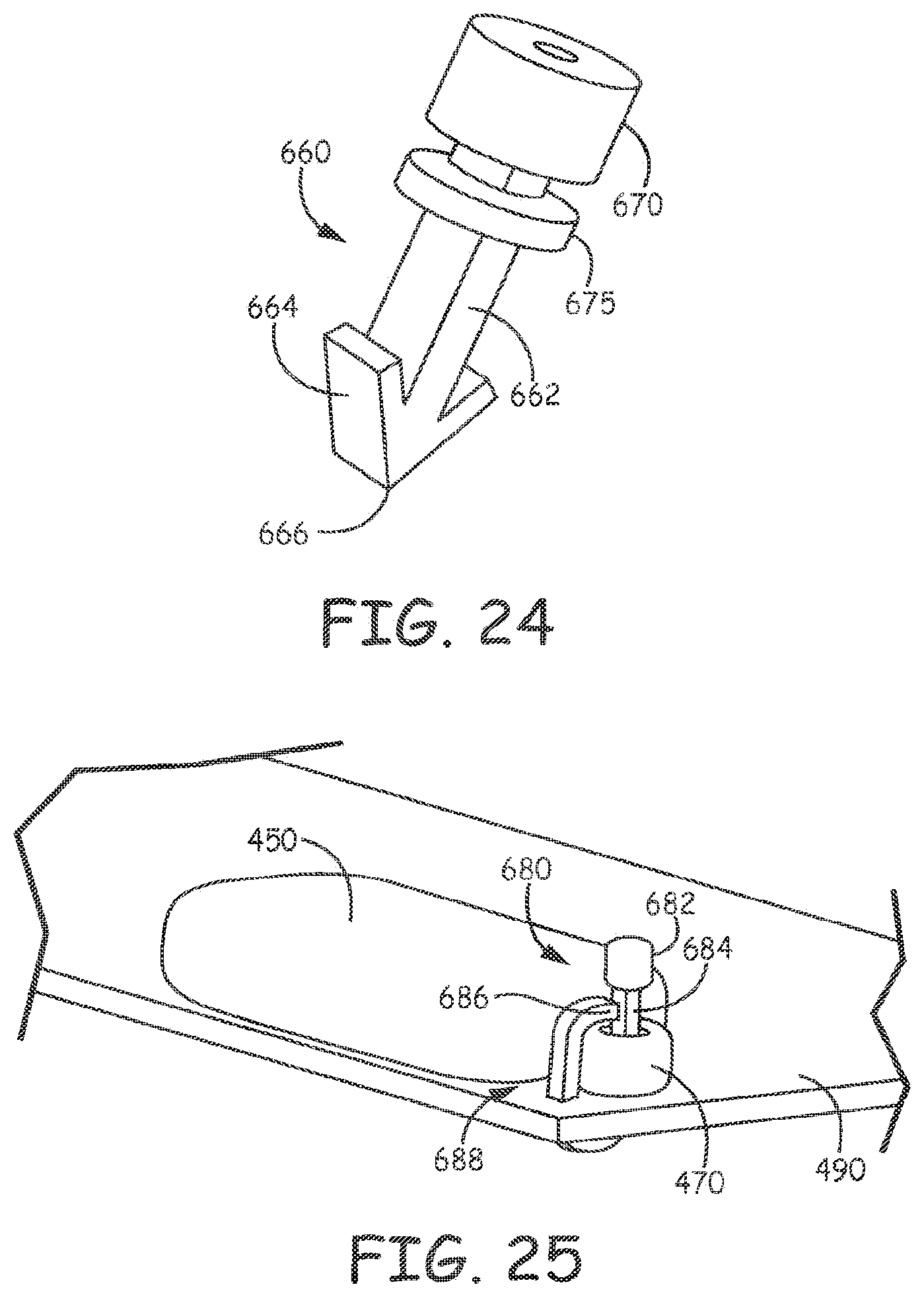 Patent US11793998 Figure 17 – Minimally invasive implantable neurostimulation system