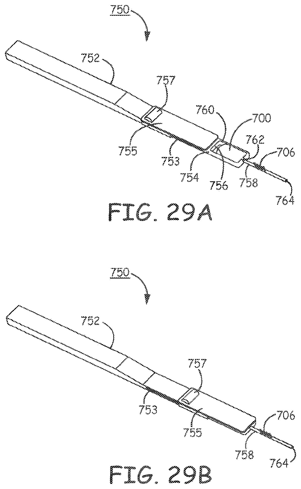 Patent US11793998 Figure 19 – Minimally invasive implantable neurostimulation system