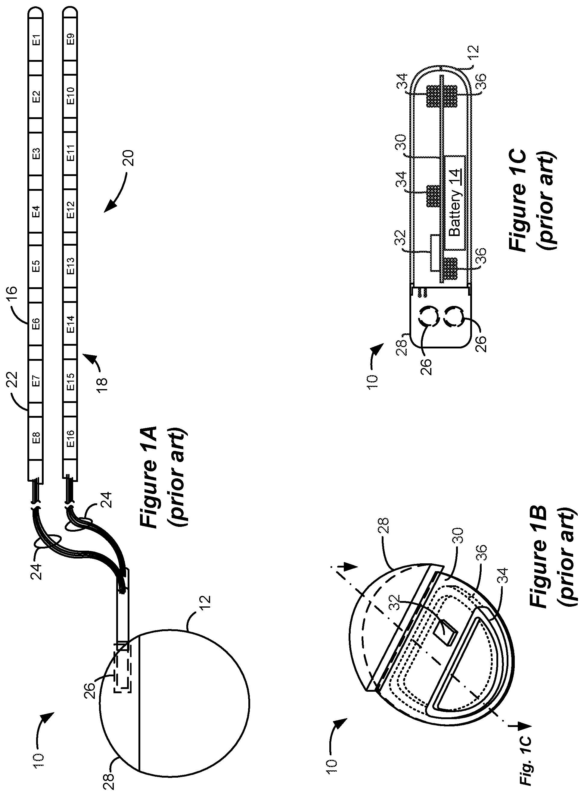 Patent US11793999 Figure 1 – Pulse definition circuitry for creating stimulation waveforms in an implantable pulse generator