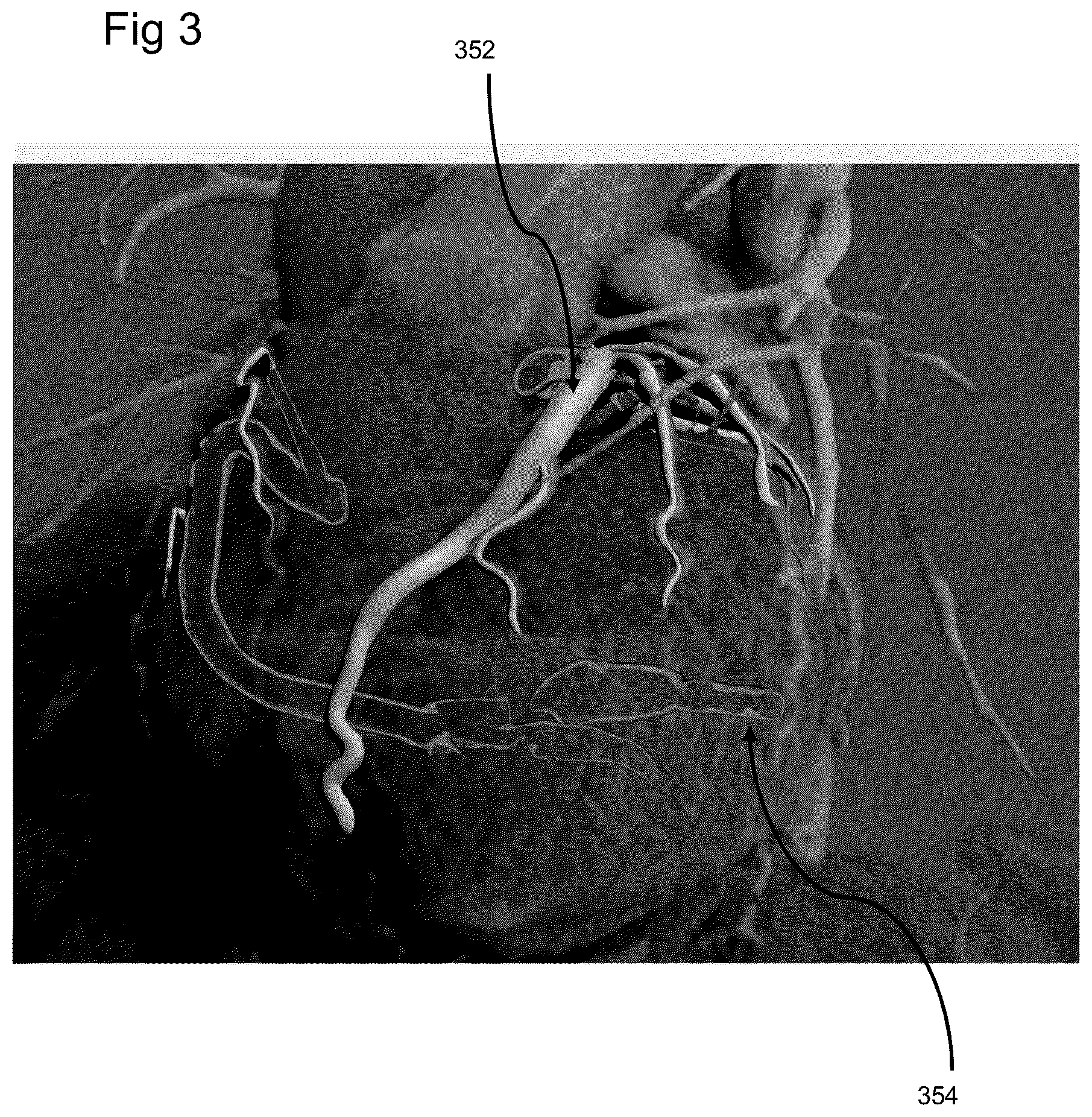 Patent US11810243 Figure 3 – Method of rendering a volume and a surface embedded in the volume