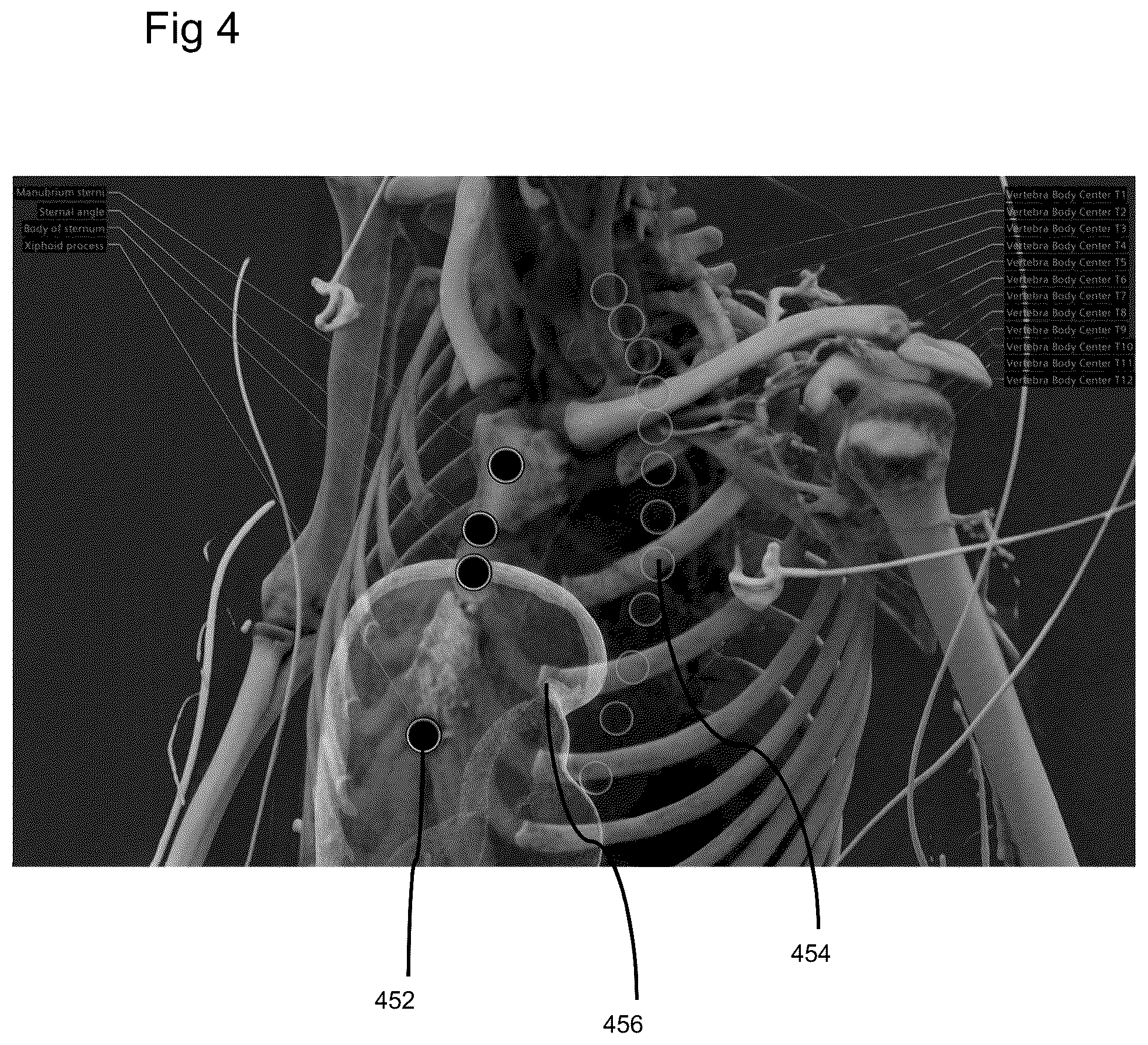 Patent US11810243 Figure 4 – Method of rendering a volume and a surface embedded in the volume